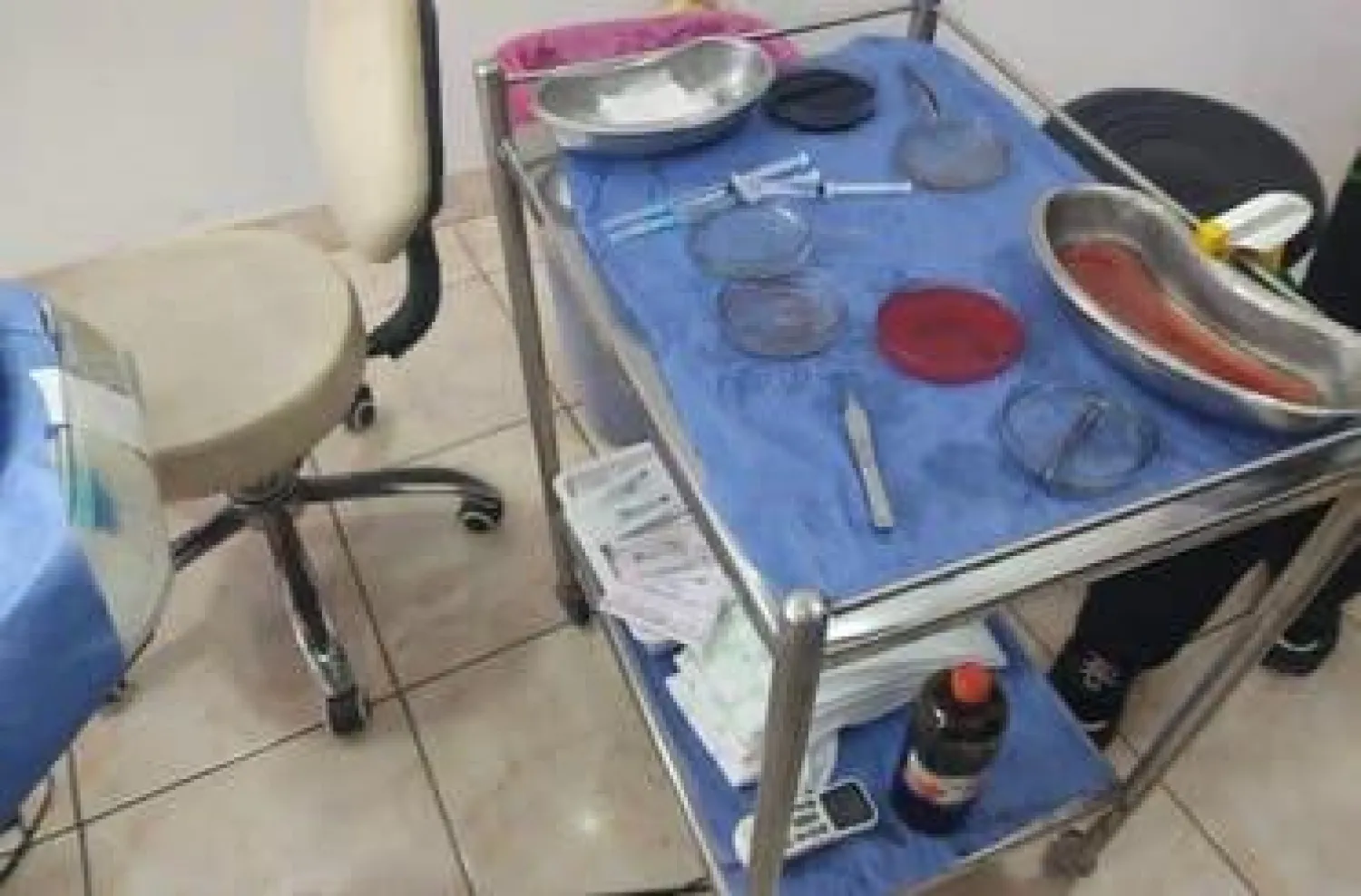 من مضبوطات مركز زراعة الشعر «المخالف» في مدينة المنصورة (متداولة)