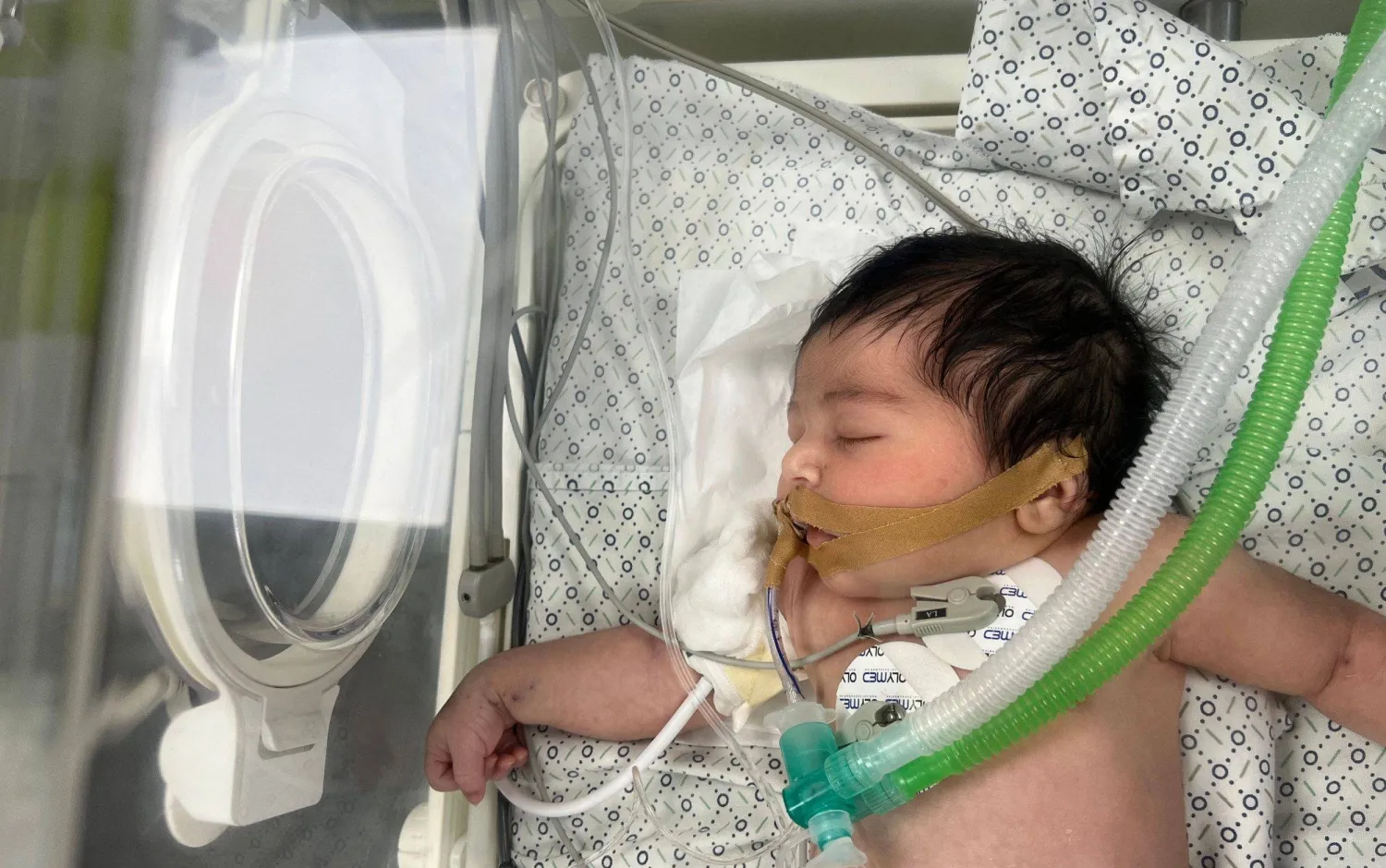 طفلة مولودة حديثا في غزة (أرشيفية - أ.ف.ب)