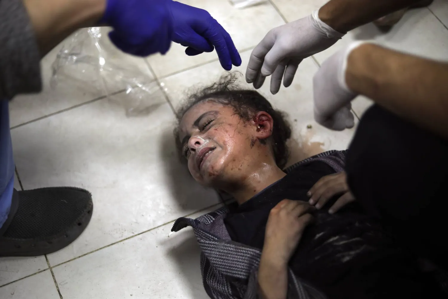 طفلة جريحة جراء القصف الإسرائيلي على مجمع ناصر الطبي في خان يونس (أ.ب)