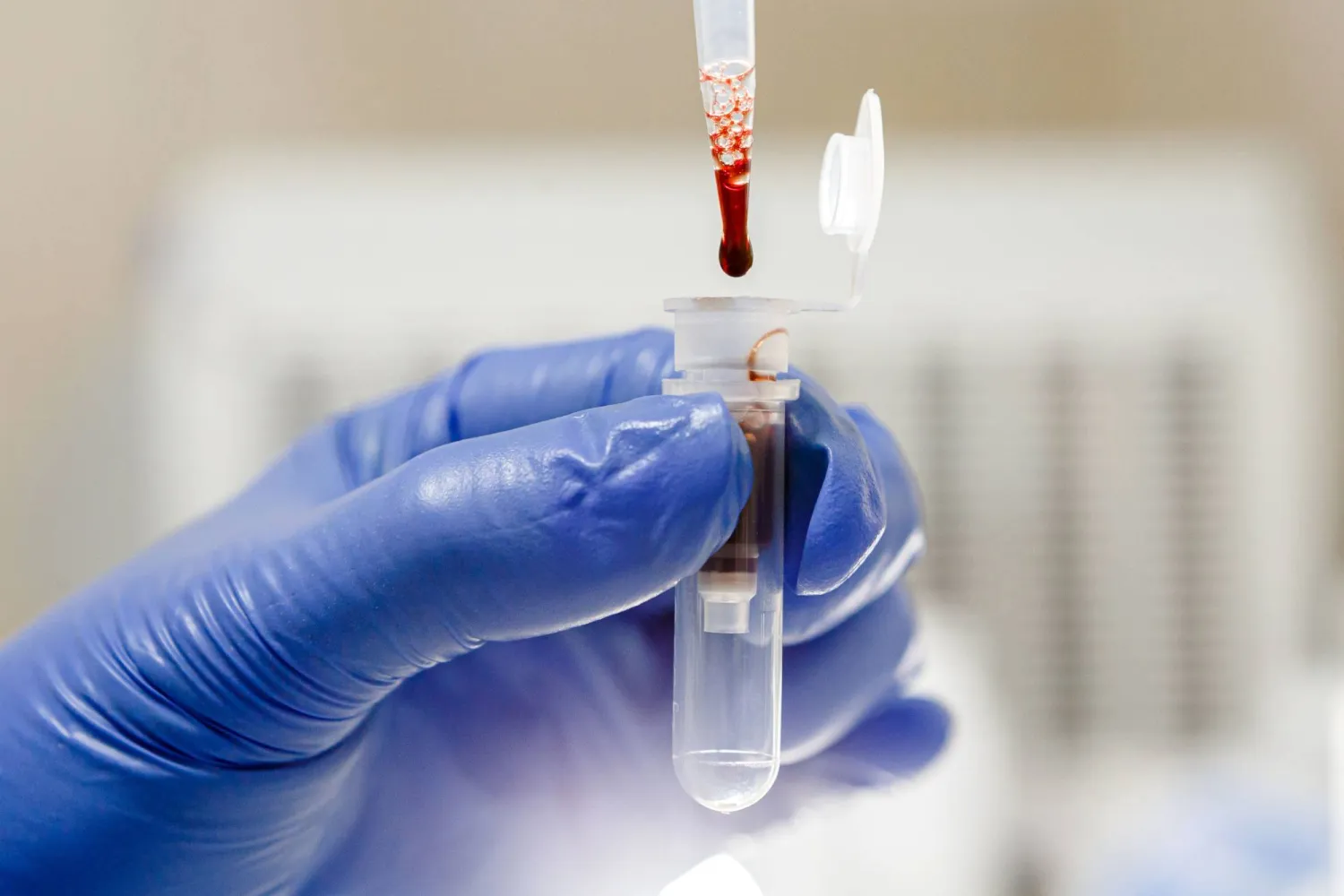 ابتكار مادة ماصة تنقّي الدم من الفيروسات والبكتيريا والسموم