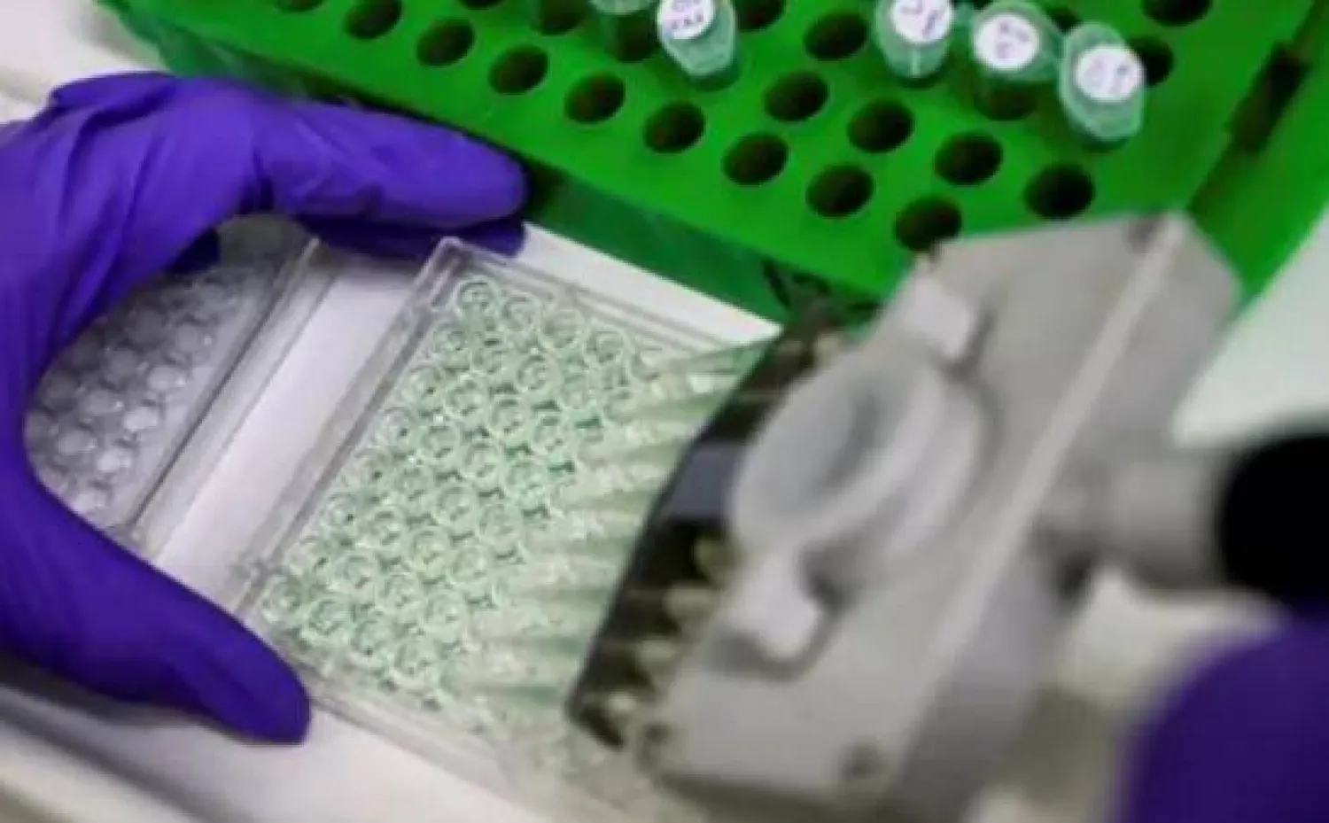 علماء يجدون «مفتاحًا» يمنع الجهاز المناعي من مهاجمة الخلايا السليمة