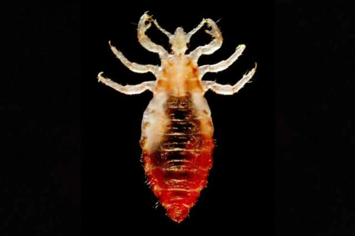 İnsan kanıyla beslenen vücut biti, kalabalık ortamlarda yaşayan kişilere bulaşabiliyor (ABD Hastalık Kontrol ve Korunma Merkezleri)