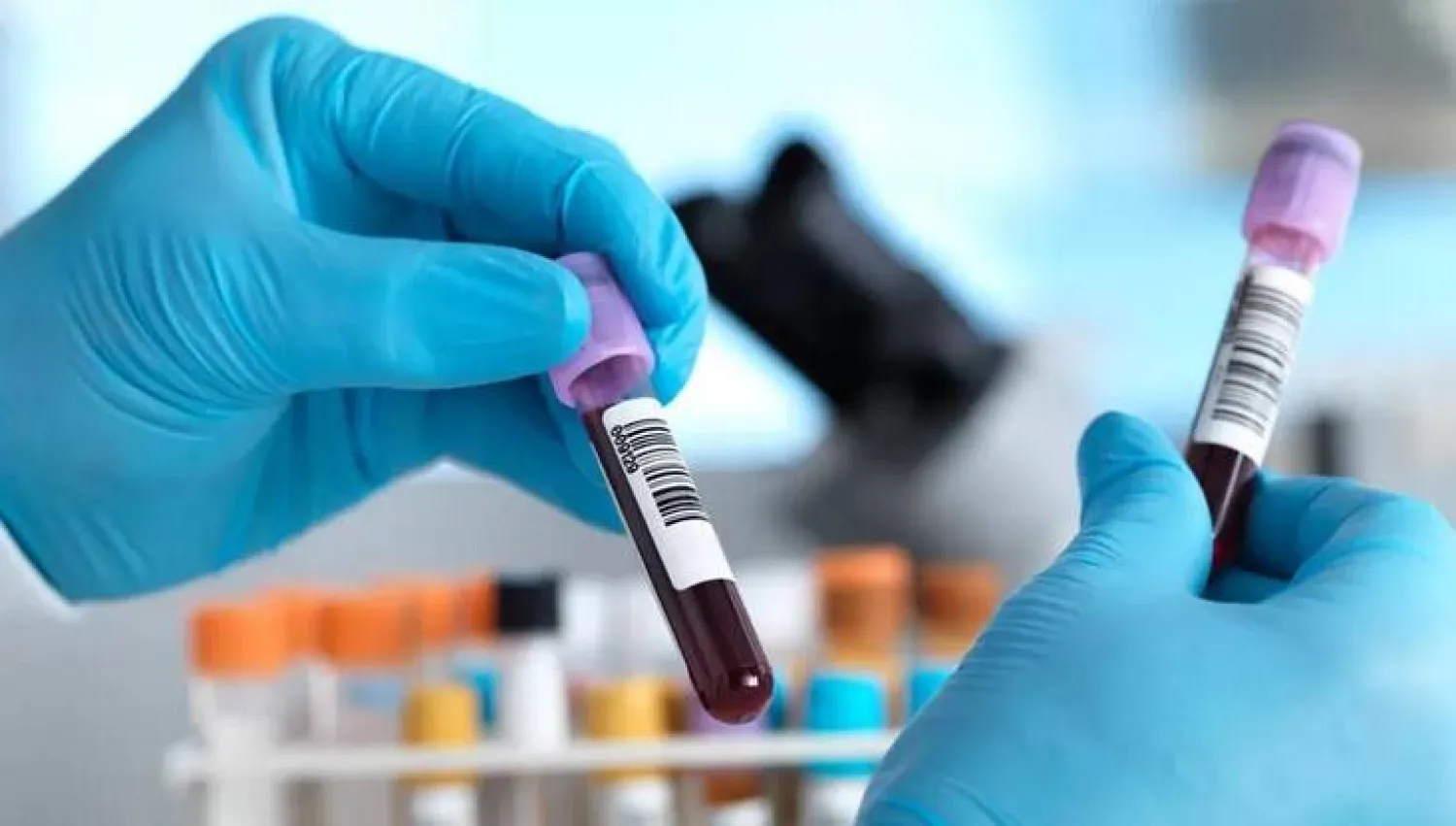 اختبار دم جديد يحذر من الإصابة بالسرطان قبل سبع سنوات !