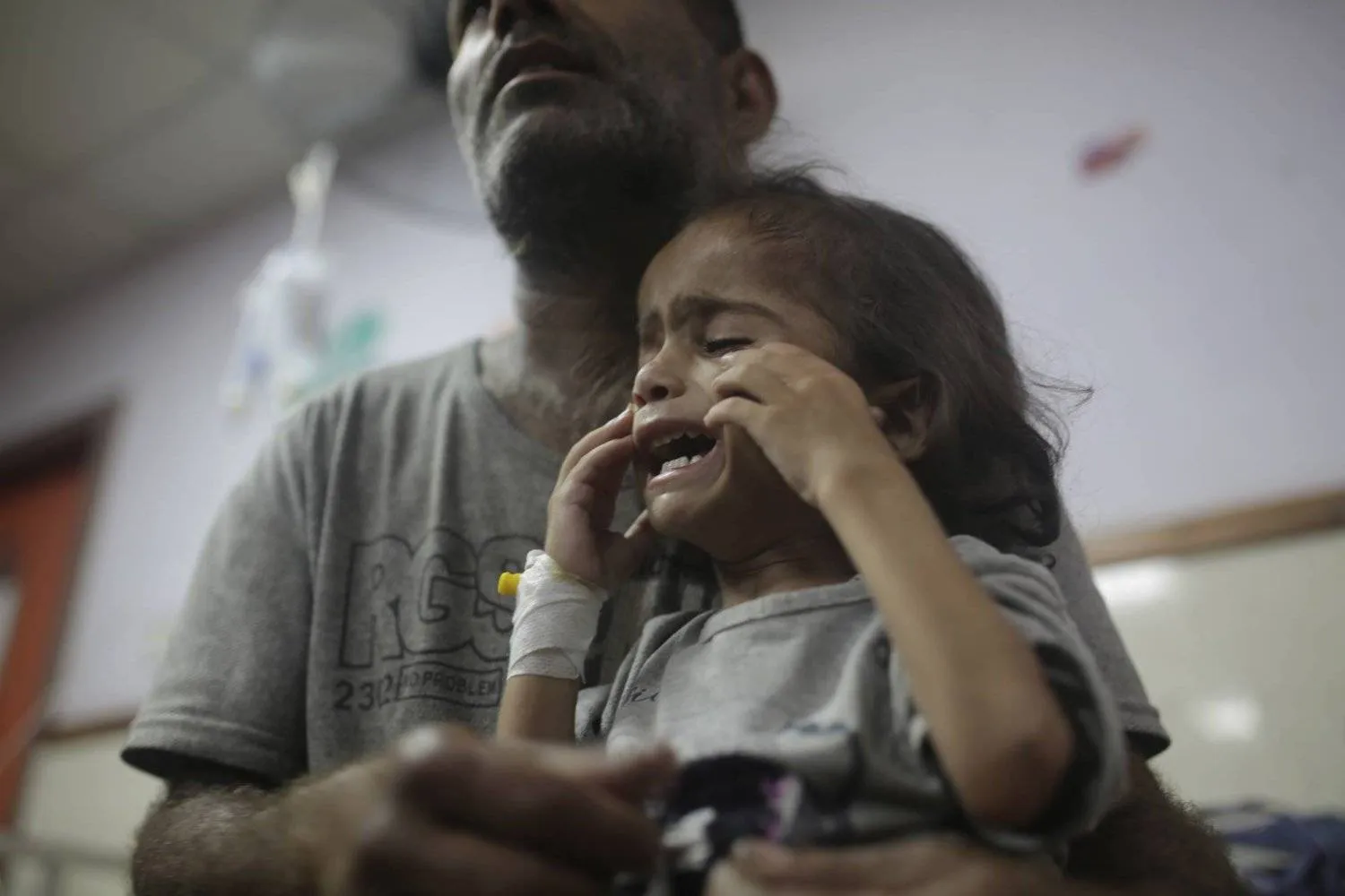 
A man holds his daughter, 3, who suffers from diabetes, a weakened immune system, and malnutrition, at Al-Aqsa Martyrs Hospital in Deir al-Balah in the central Gaza Strip, where she is receiving treatment, Saturday, June 1, 2024. (AP Photo/Jehad Alshrafi)
