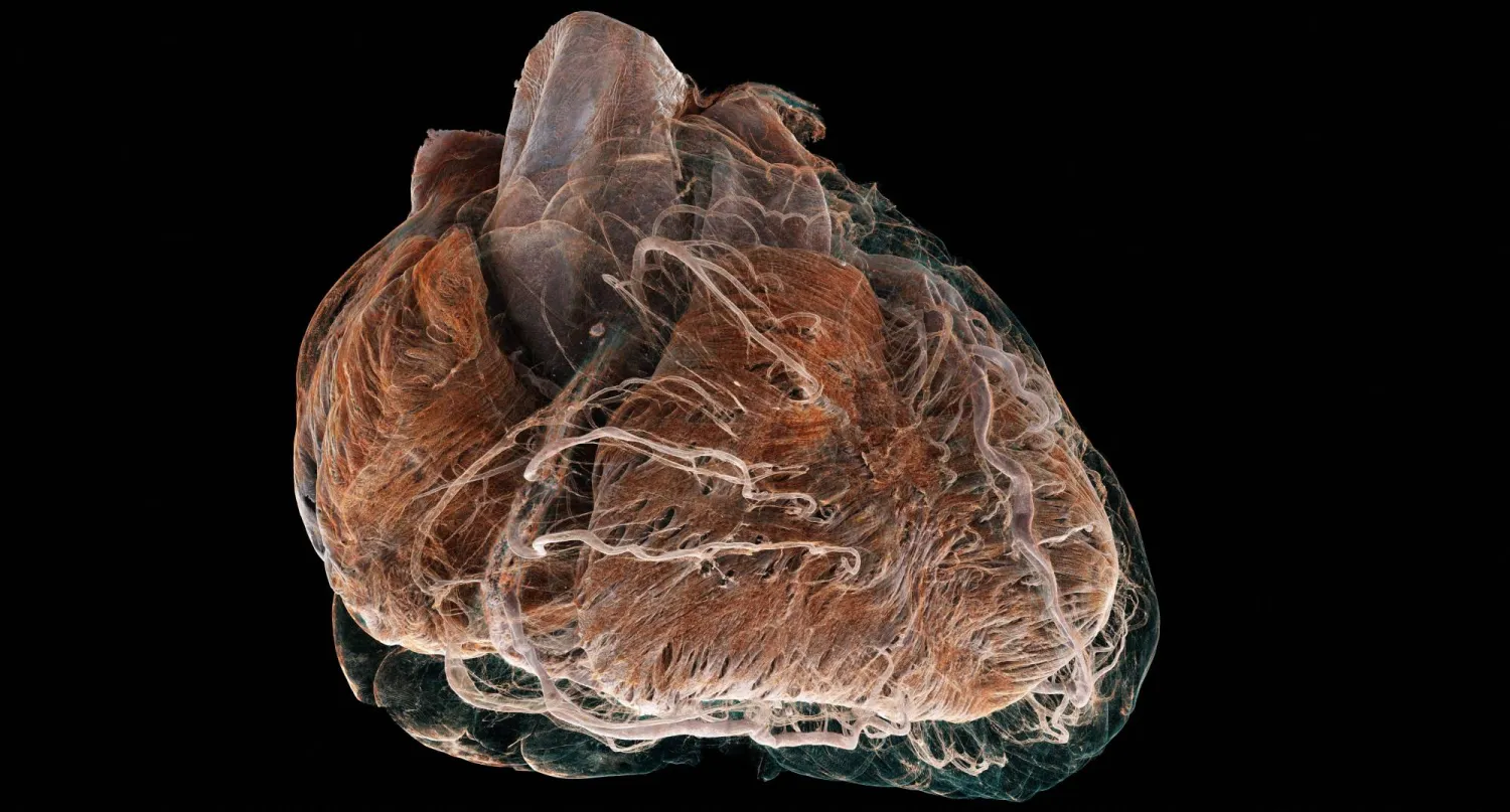 تتيح هذه التقنية الحصول على نظرة عامة ثلاثية الأبعاد (أ.ف.ب)