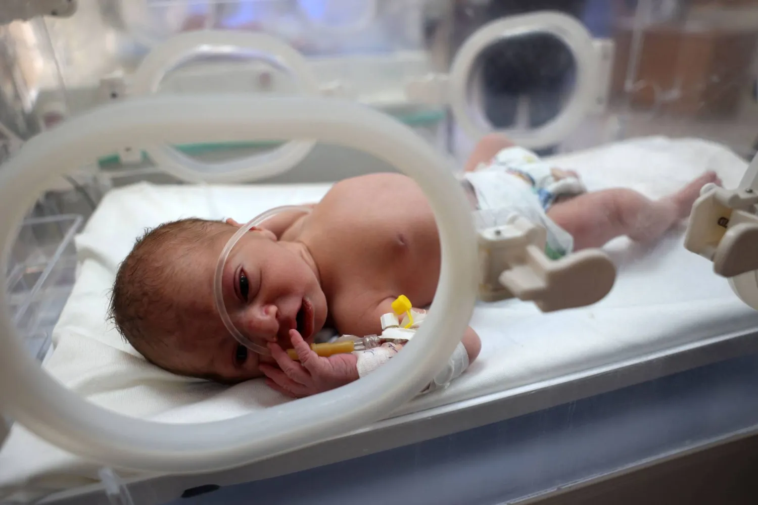 الطفل في المستشفى بعد وفاة والدته (أ.ف.ب)