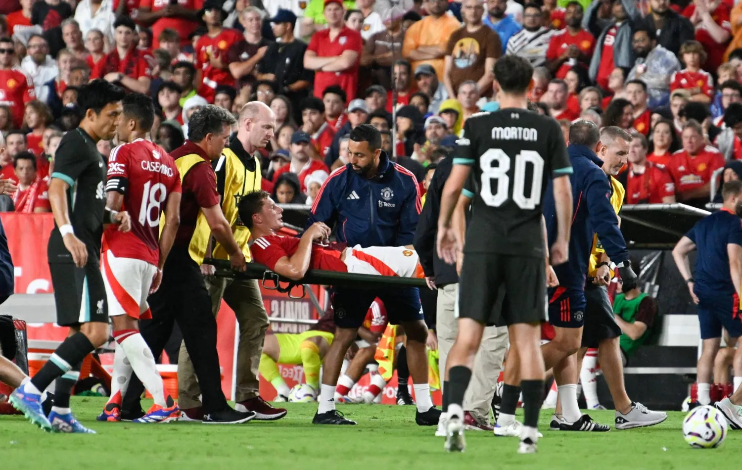 تن هاغ يتعين عليه أن يتعامل مع كثير من الإصابات خلال جولة الفريق بأميركا (أ.ف.ب)