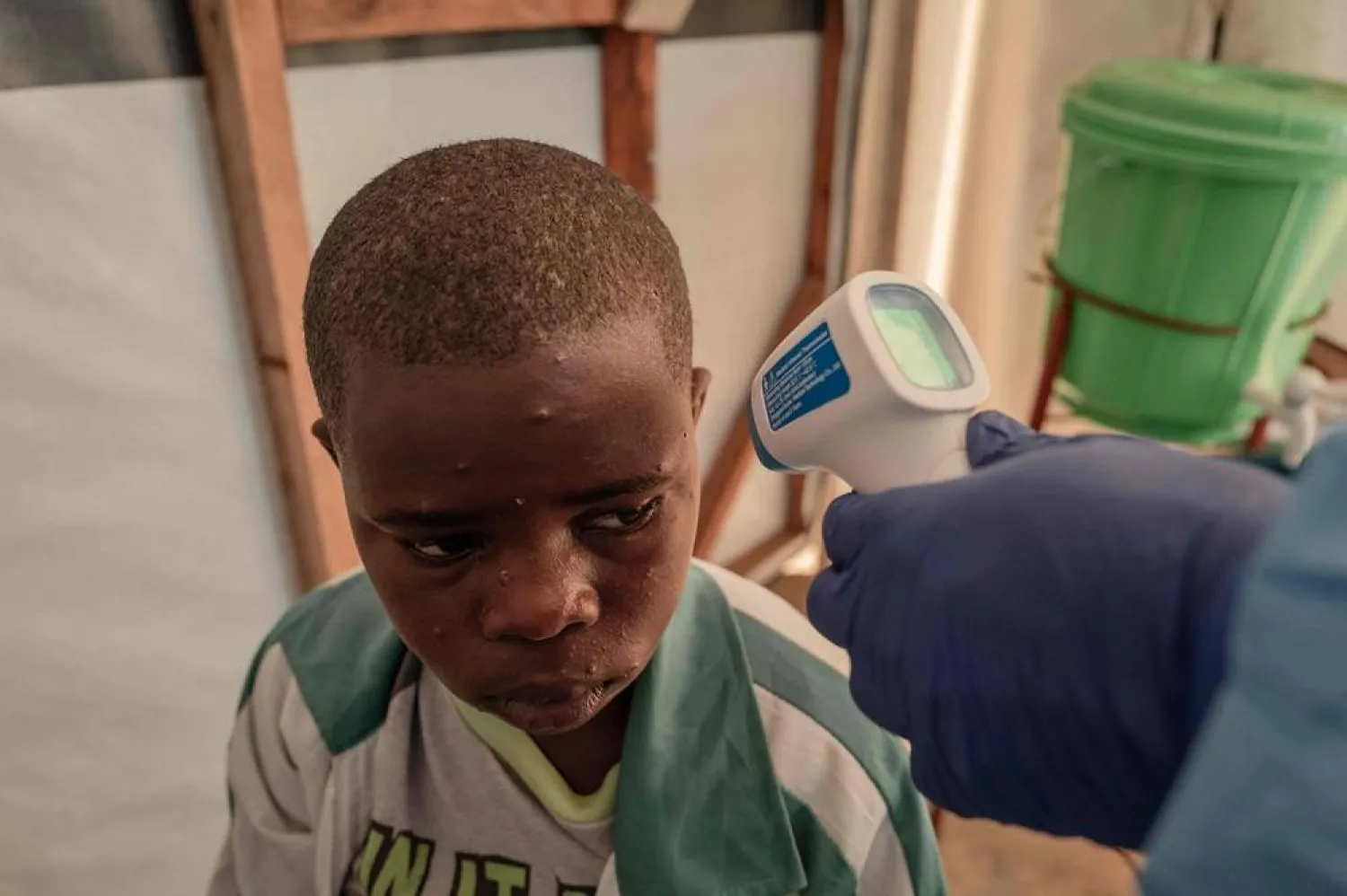 A patient has his temperature taken at the Mpox treatment center at Nyiragongo General Referral Hospital, north of Goma on August 17, 2024. (AFP)