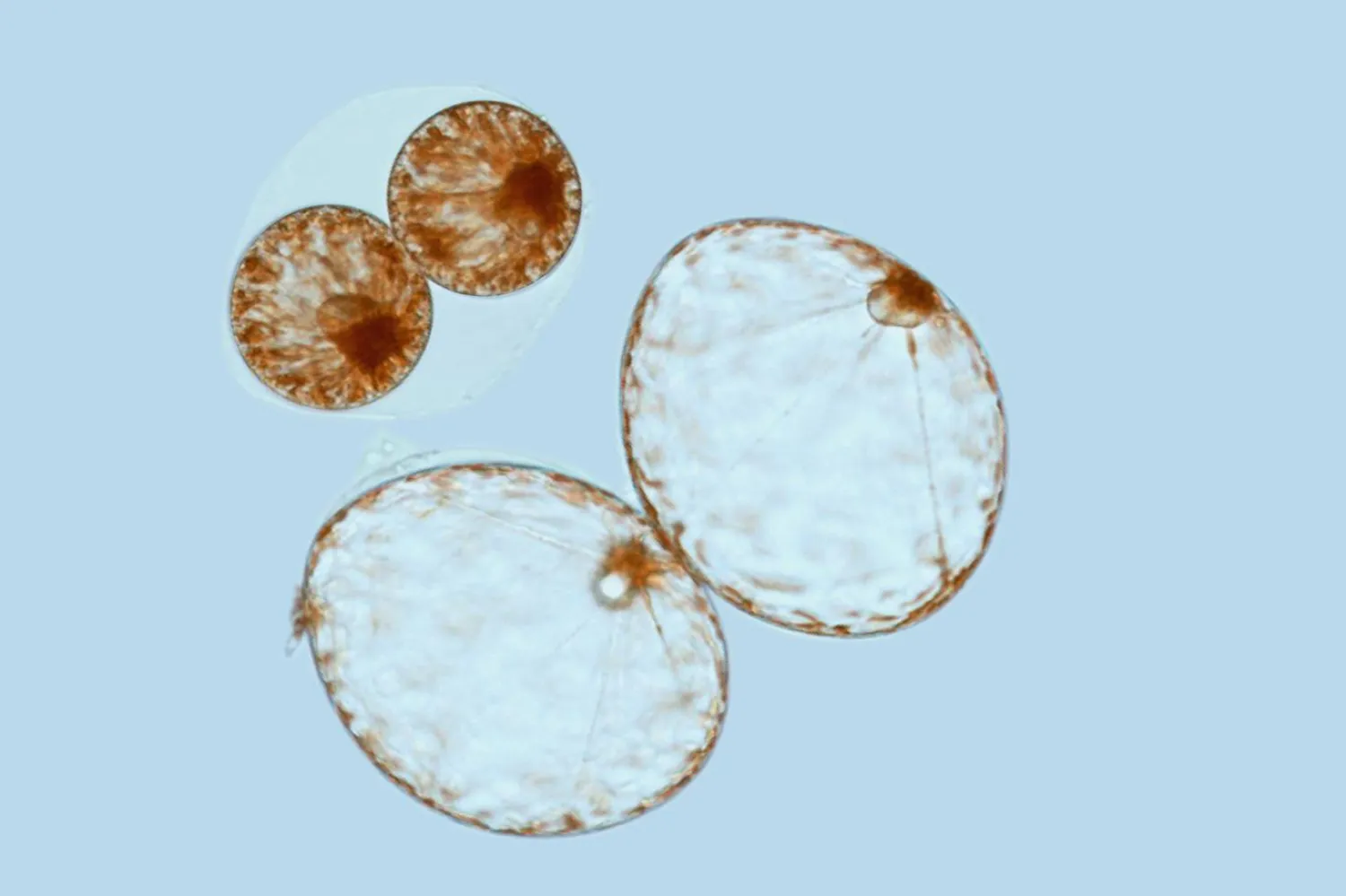 Kendisini şişiren planktonun içindeki su, etraftaki deniz suyundan daha hafif olduğu için yukarı çıkıyor (Prakash Lab/Stanford Üniversitesi)