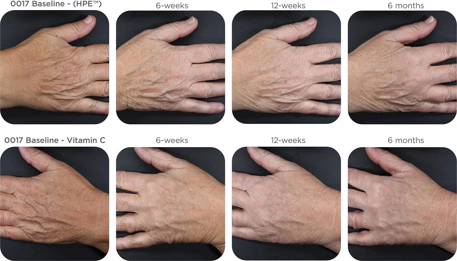 الصور قبل العلاج وبعده (دورية Plastic and Reconstructive Surgery)