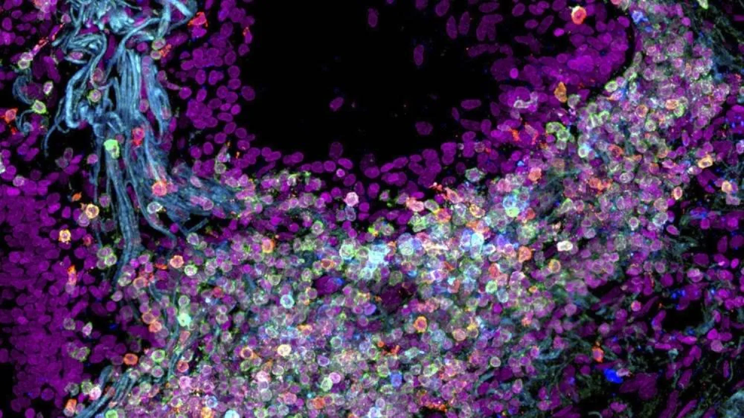 This image provided by Nathan Richoz shows a T cell aggregate in a human trachea biopsy on July 12, 2021, at the University of Cambridge in Cambridge, England. (Nathan Richoz/Clatworthy Lab/University of Cambridge via AP) 