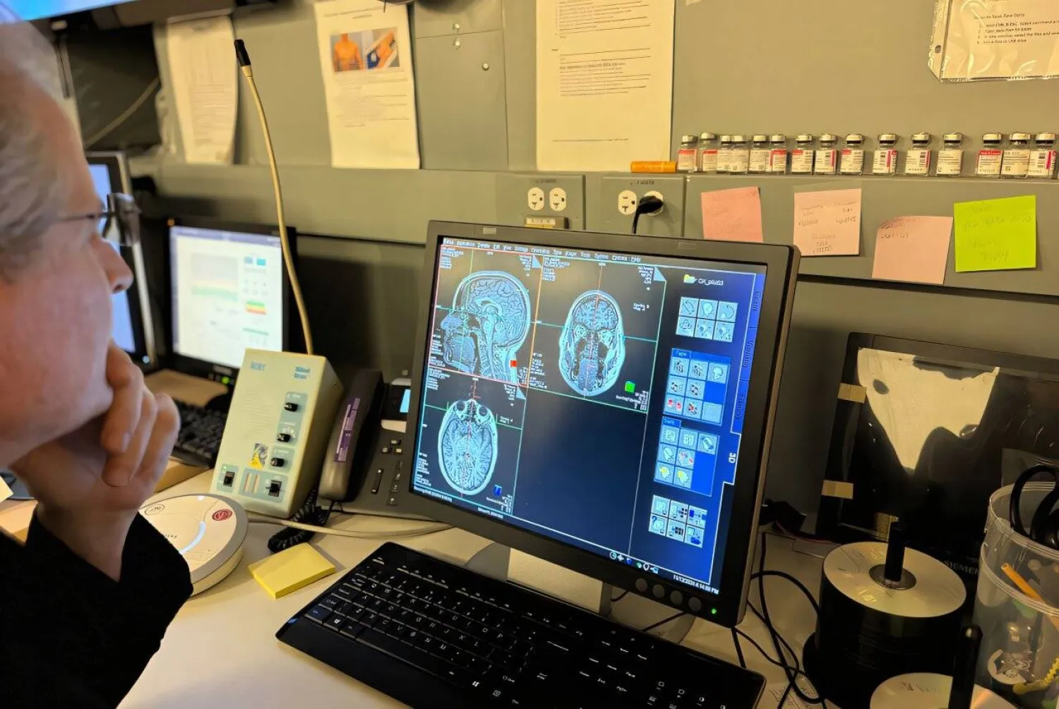 صورة لمسح الدماغ أثناء التصوير بالرنين المغناطيسي (جامعة نورث وسترن)