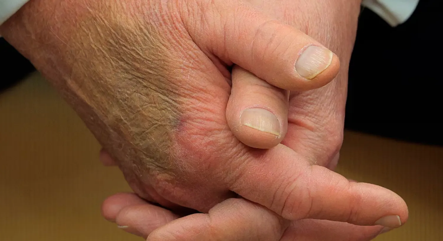 صورة للكدمة تداولها مستخدمو موقع «إكس»