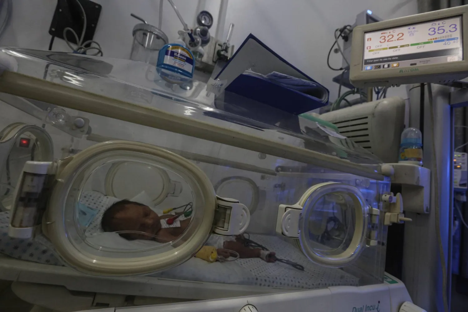 طفل يتلقى العلاج داخل أحد مستشفيات غزة (د.ب.أ)