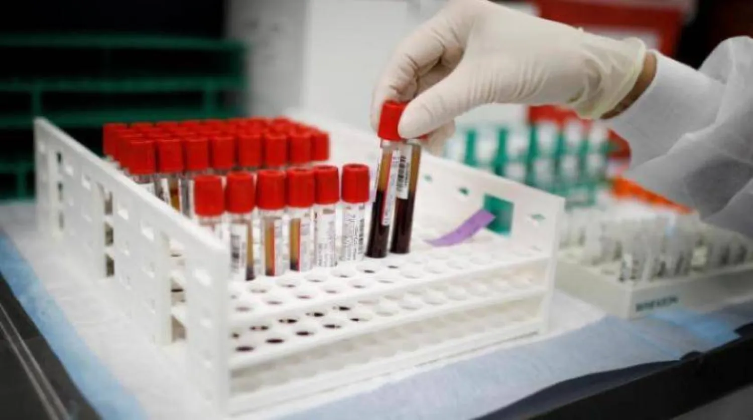 الاختبار يمكنه أن يتنبأ بخطر الإصابة بأمراض خطيرة مثل السرطان (رويترز)