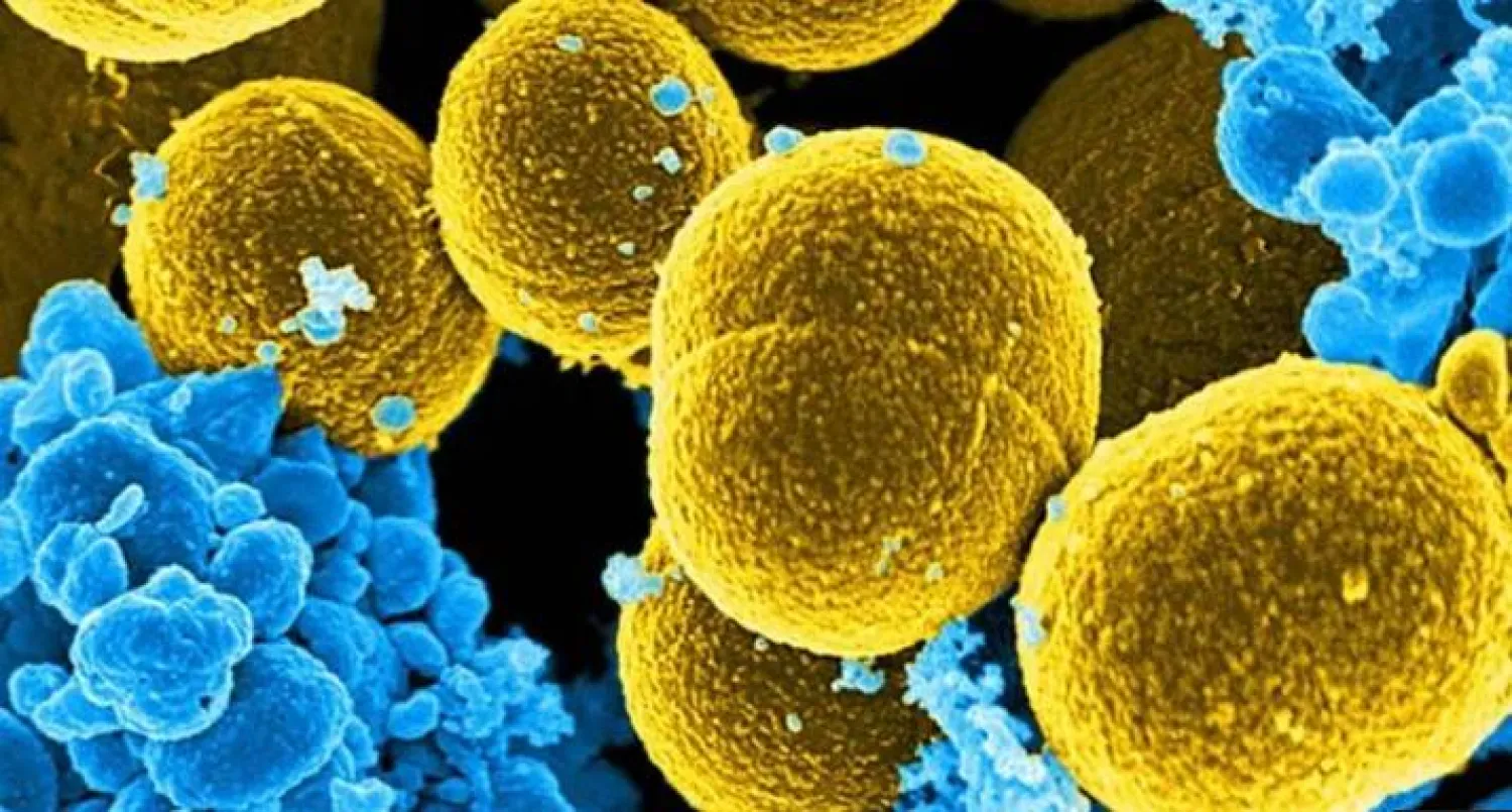 عدوى المكورات العنقودية تحصد أرواح مئات الآلاف من الأشخاص حول العالم سنوياً (رويترز)