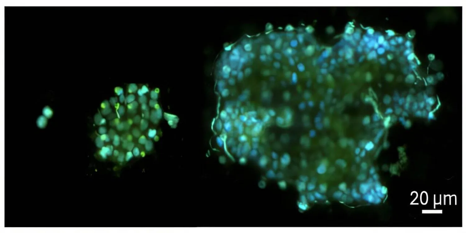 تنتقل خلايا الورم النقيلي بمجرى الدم في تجمعات تشبه العناقيد (جامعة ماكغيل)