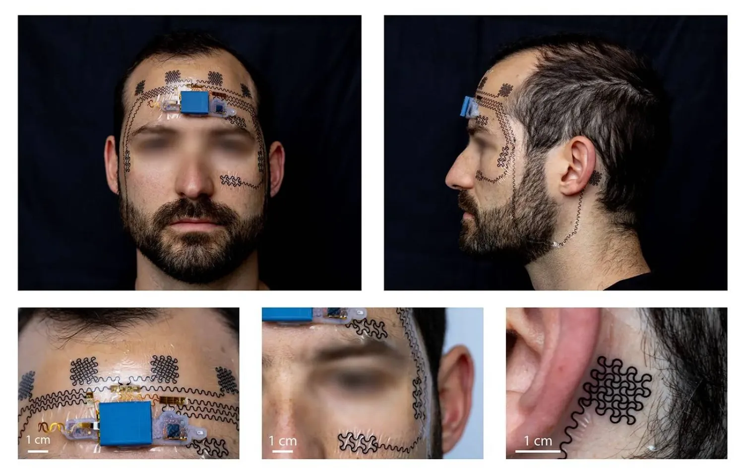 تقنية رصد الإجهاد الذهني تعتمد على وشم إلكتروني غير دائم يُلصق على الوجه (دورية Device)