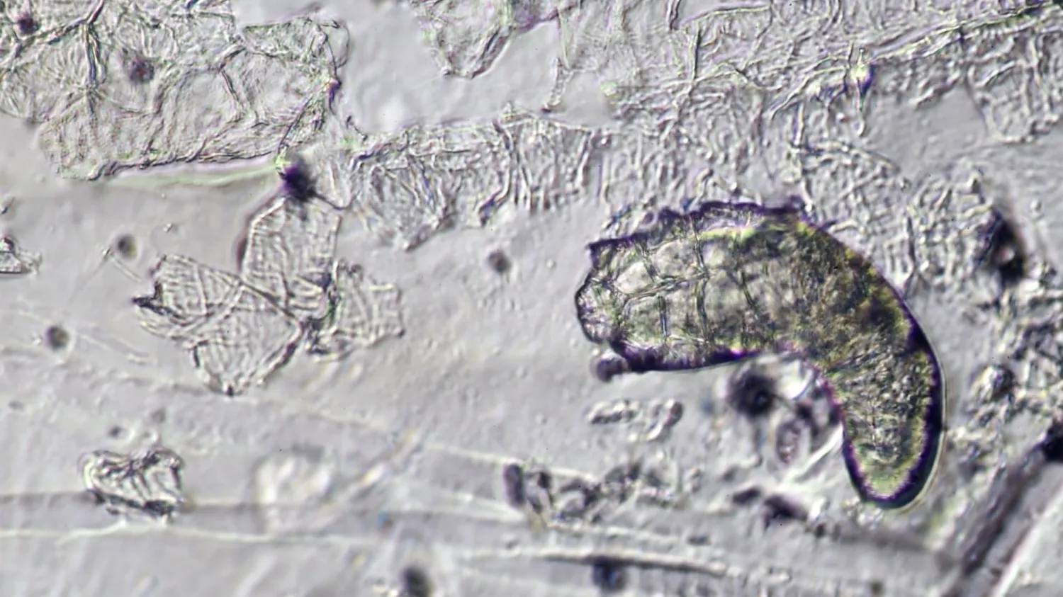 يظهر «عثّ الديموديكس» من عينة جلدية تحت المجهر (تاي مايكروكوزموس)