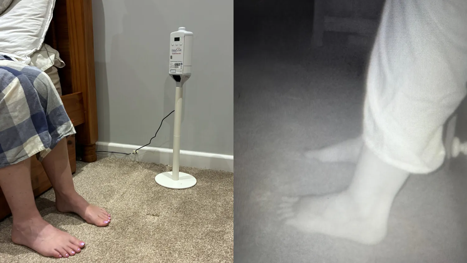 الجهاز عبارة عن ماسح ضوئي للقدم يستخدم الذكاء الاصطناعي للتعرف على العلامات التحذيرية لقصور القلب (شركة Heartfelt Technologies)