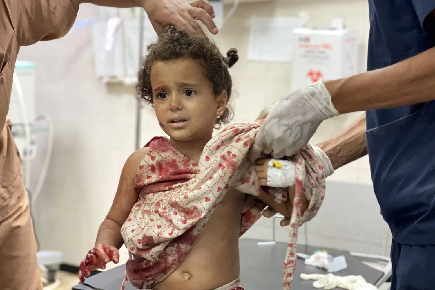 طفلة تتلقى العلاج من جروح أصيبت بها في غارة على مخيم للنازحين جنوب قطاع غزة (أ.ف.ب)