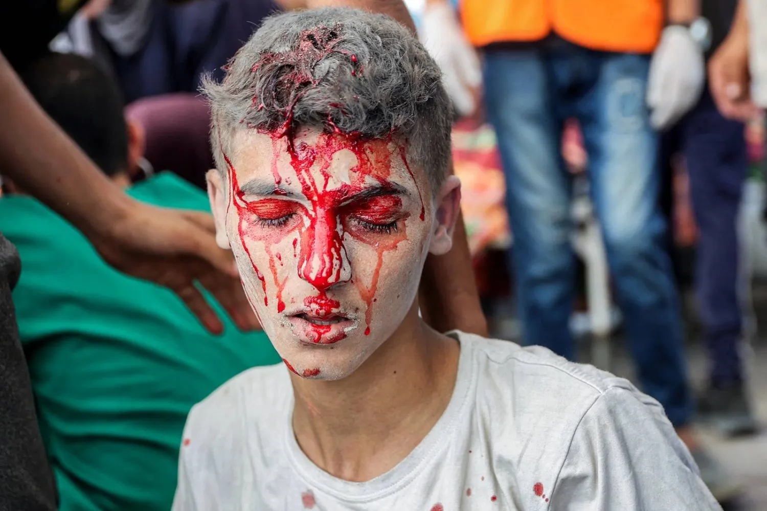 آثار دماء على وجه شاب فلسطيني إثر قصف إسرائيلي وسط قطاع غزة (أ.ف.ب)