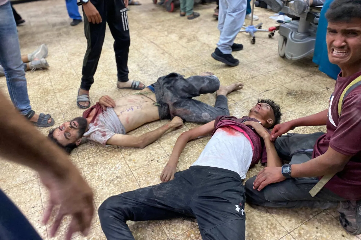 مصابون يُعالجون الجمعة في مجمع ناصر الطبي بخان يونس جنوب قطاع غزة (أ.ف.ب)