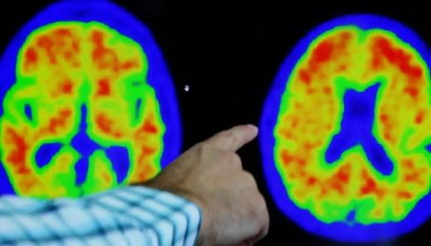 الدوبامين مادة كيميائية ننتجها في دماغنا (أرشيفية-رويترز)