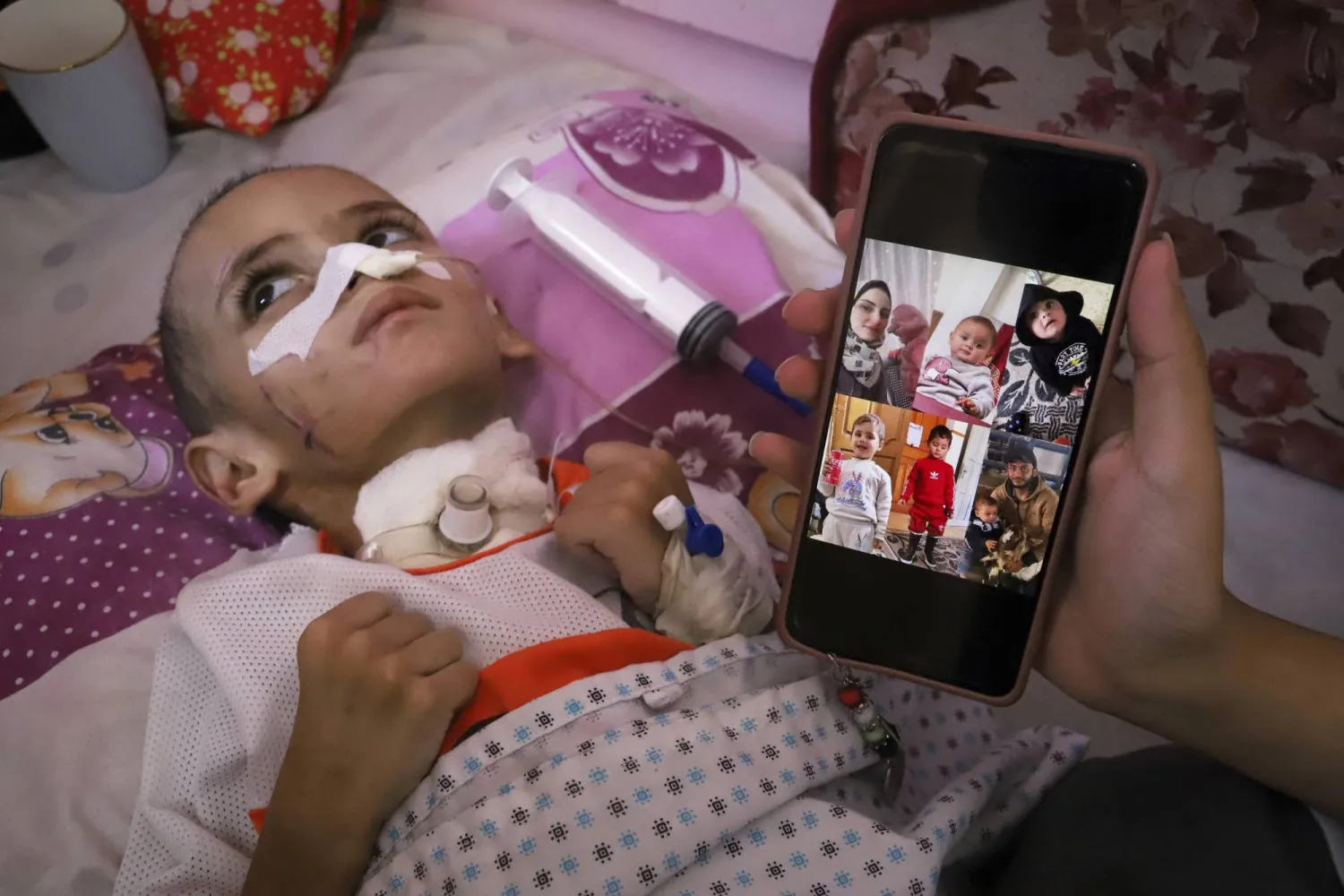 الطفل عمر الهمص يخضع للعلاج في مجمع ناصر الطبي بخان يونس جنوب قطاع غزة (أ.ب)