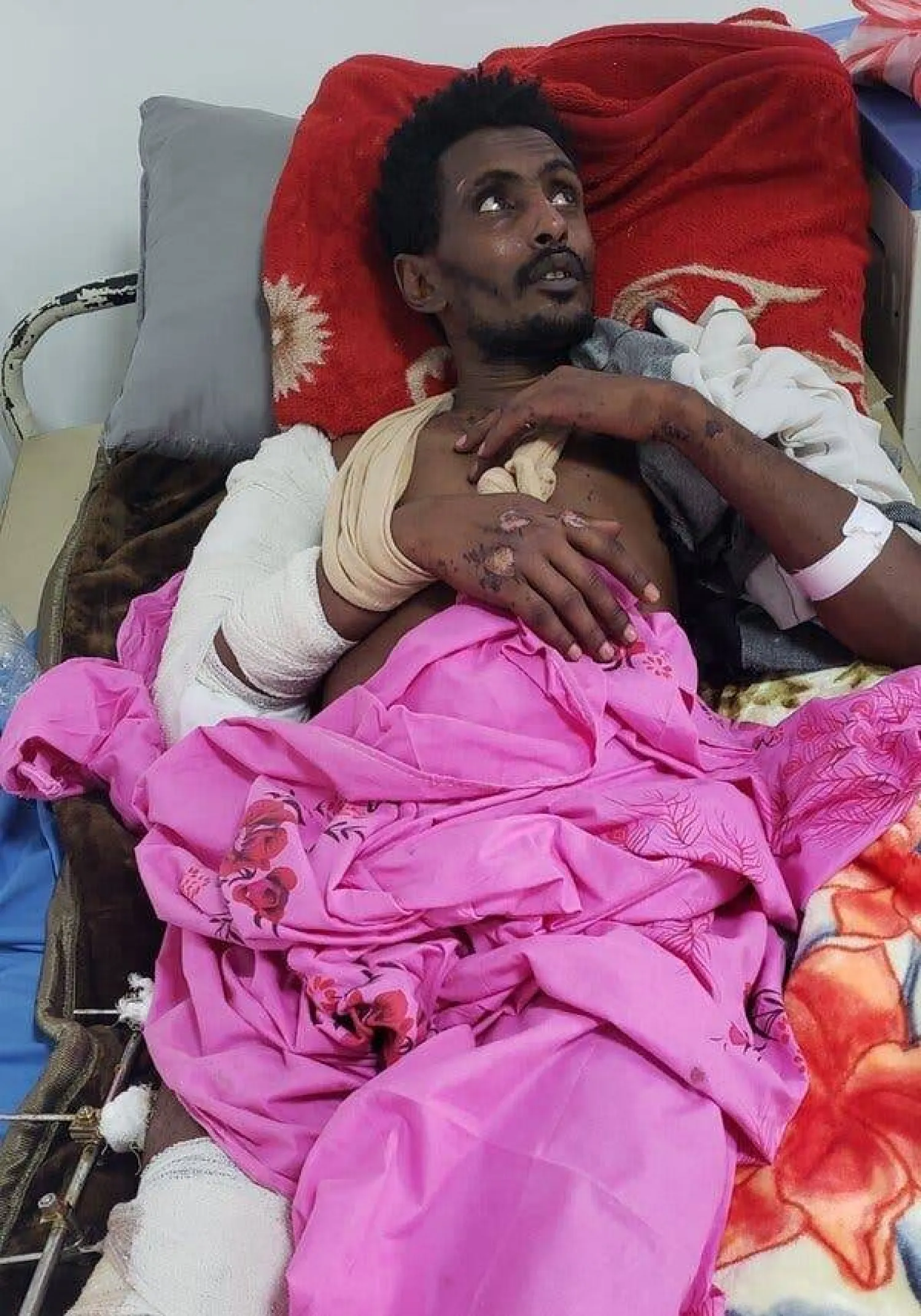 قال فانتا علي أحمد من منطقة تيغراي في إثيوبيا: «لقد دمرت القنابل الأميركية الأرض وكل من عليها». أُصيب بأبريل في قصف مركز احتجاز للمهاجرين في صعدة باليمن (نيويورك تايمز)