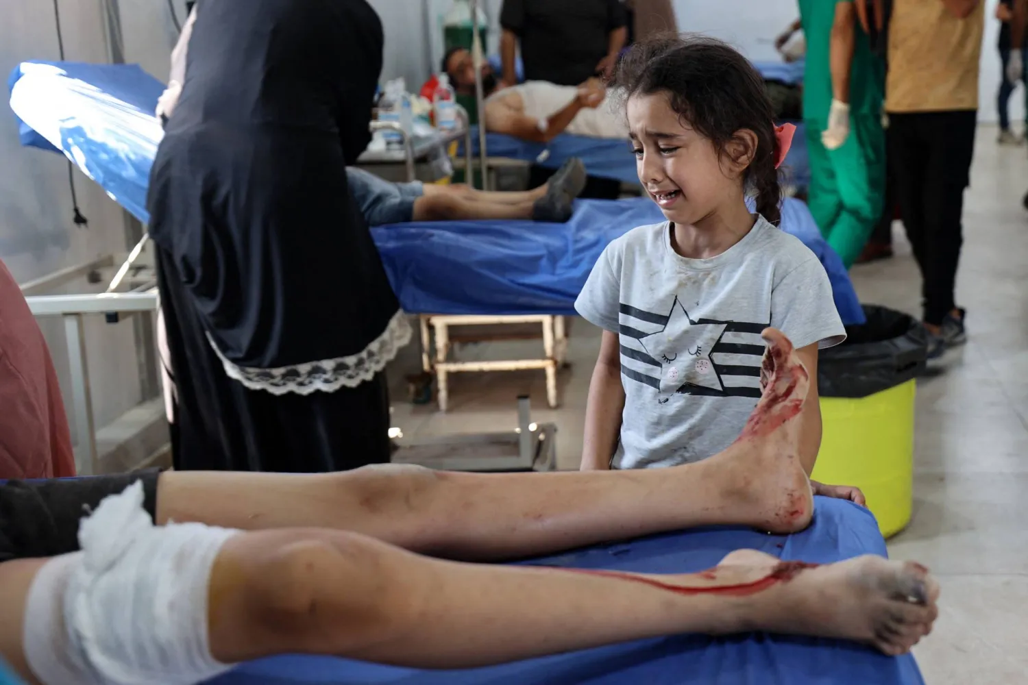 طفلة فلسطينية تبكي قرب طفل يتلقى العلاج من إصاباته في مستشفى العودة بالنصيرات وسط غزة الأحد (أ.ف.ب)
