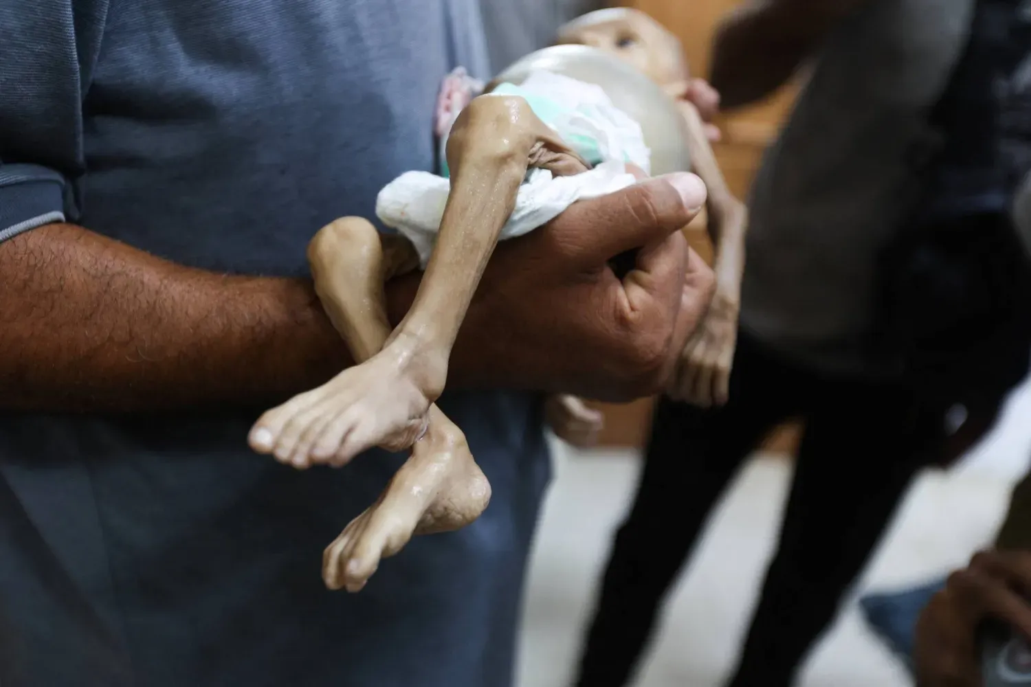 Gazze Şeridi'nin güneyindeki Han Yunus'ta yetersiz beslenme nedeniyle hayatını kaybeden Filistinli bir kız çocuğunun cenazesini taşıyan bir adam (Reuters)