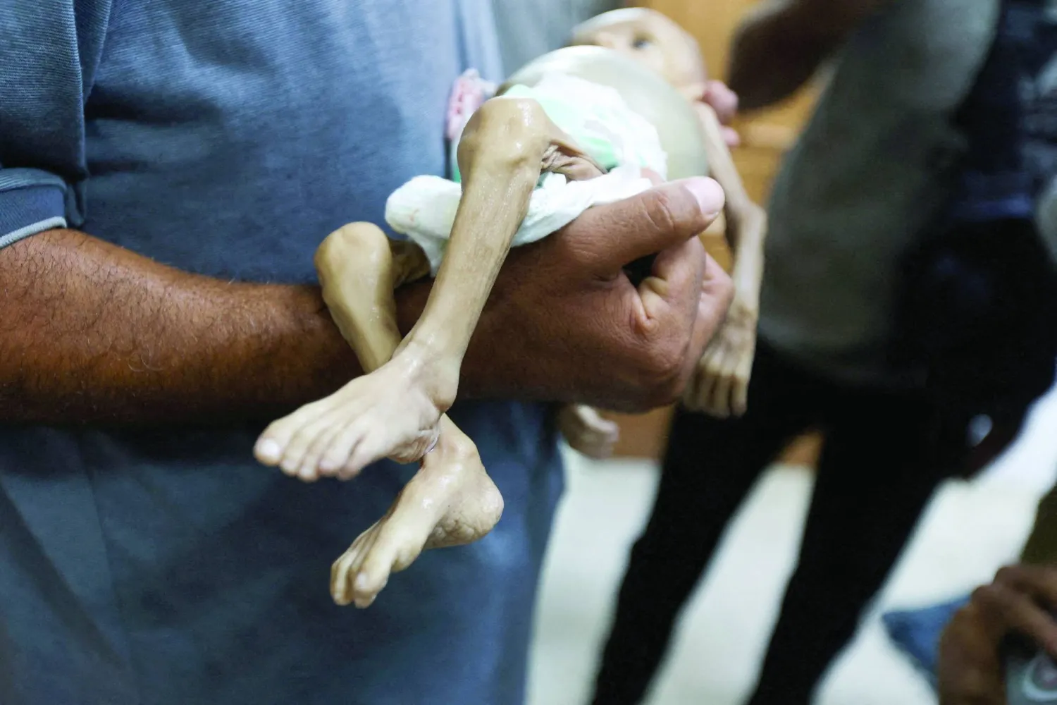 FILE PHOTO:  SENSITIVE MATERIAL. THIS IMAGE MAY OFFEND OR DISTURB    A man carries the body of Palestinian baby Zainab Abu Haleeb, who died due to malnutrition, according to health officials, at Nasser Hospital in Khan Younis, southern Gaza Strip, July 26, 2025. REUTERS/Ramadan Abed    