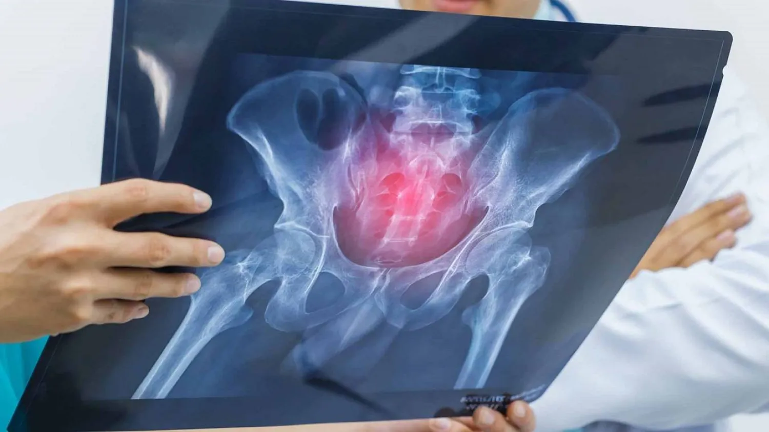 مرض هشاشة العظام يؤثر على العمود الفقري (جامعة هدرسفيلد البريطانية)