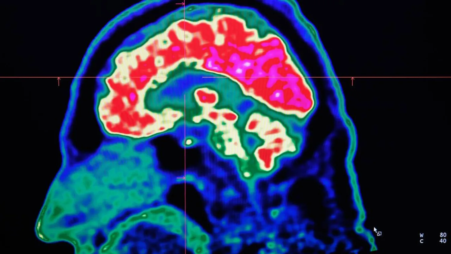 Microplastics are everywhere, but data is still lacking about how they could be affecting our brains. Fred TANNEAU / AFP/File