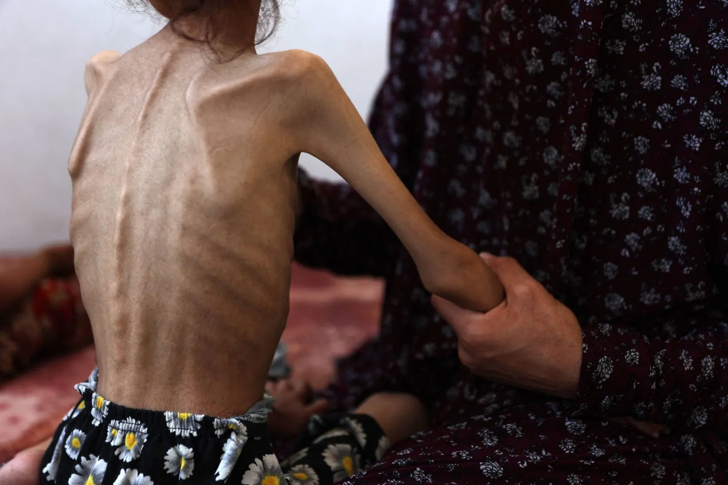 مريم دواس الطفلة الفلسطينية البالغة من العمر 9 سنوات التي تعاني من سوء التغذية تجلس على الأرض مع والدتها في حي الرمال بمدينة غزة (أ.ف.ب)