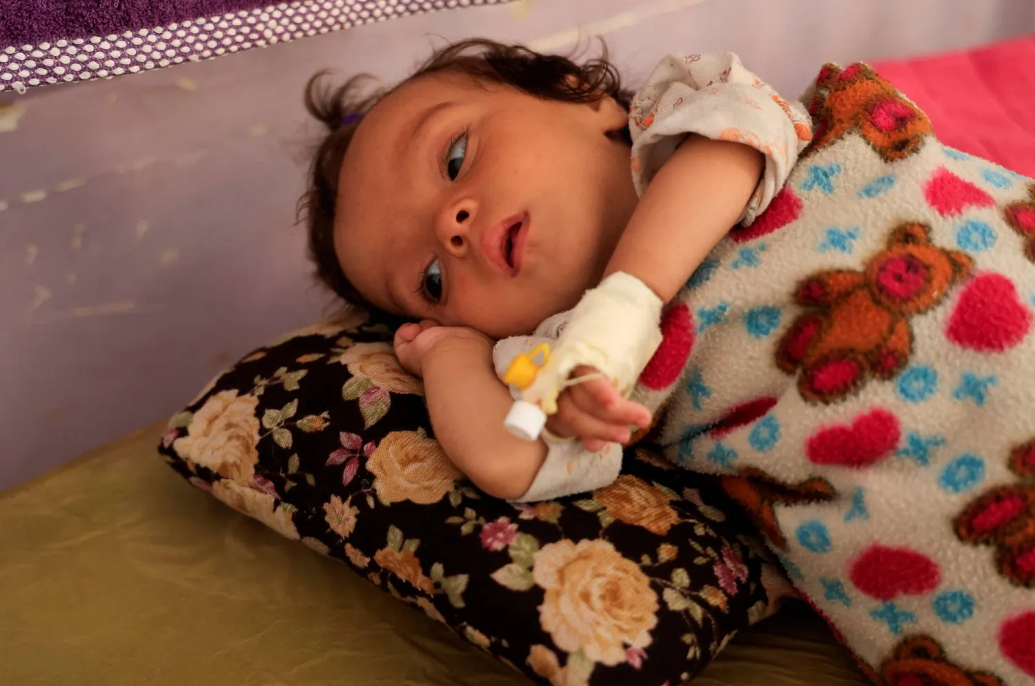 طفلة فلسطينية تعاني من سوء التغذية الحاد تتلقى العلاج في قسم الأطفال بمستشفى شهداء الأقصى (رويترز)