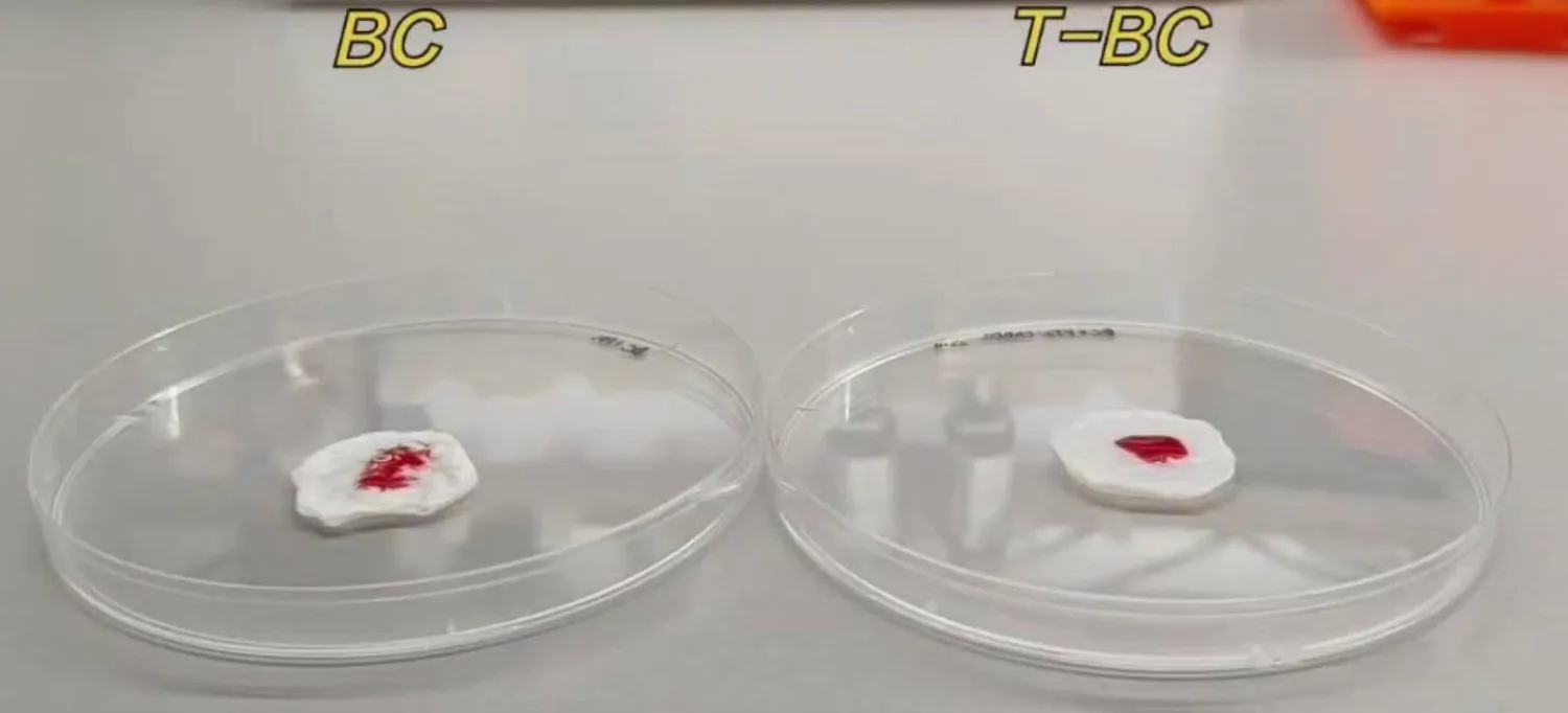 الضمادة الجديدة قادرة على تحقيق وقف فوري للنزيف خلال دقيقة واحدة فقط (دورية أدفانسد ماتيريالز)