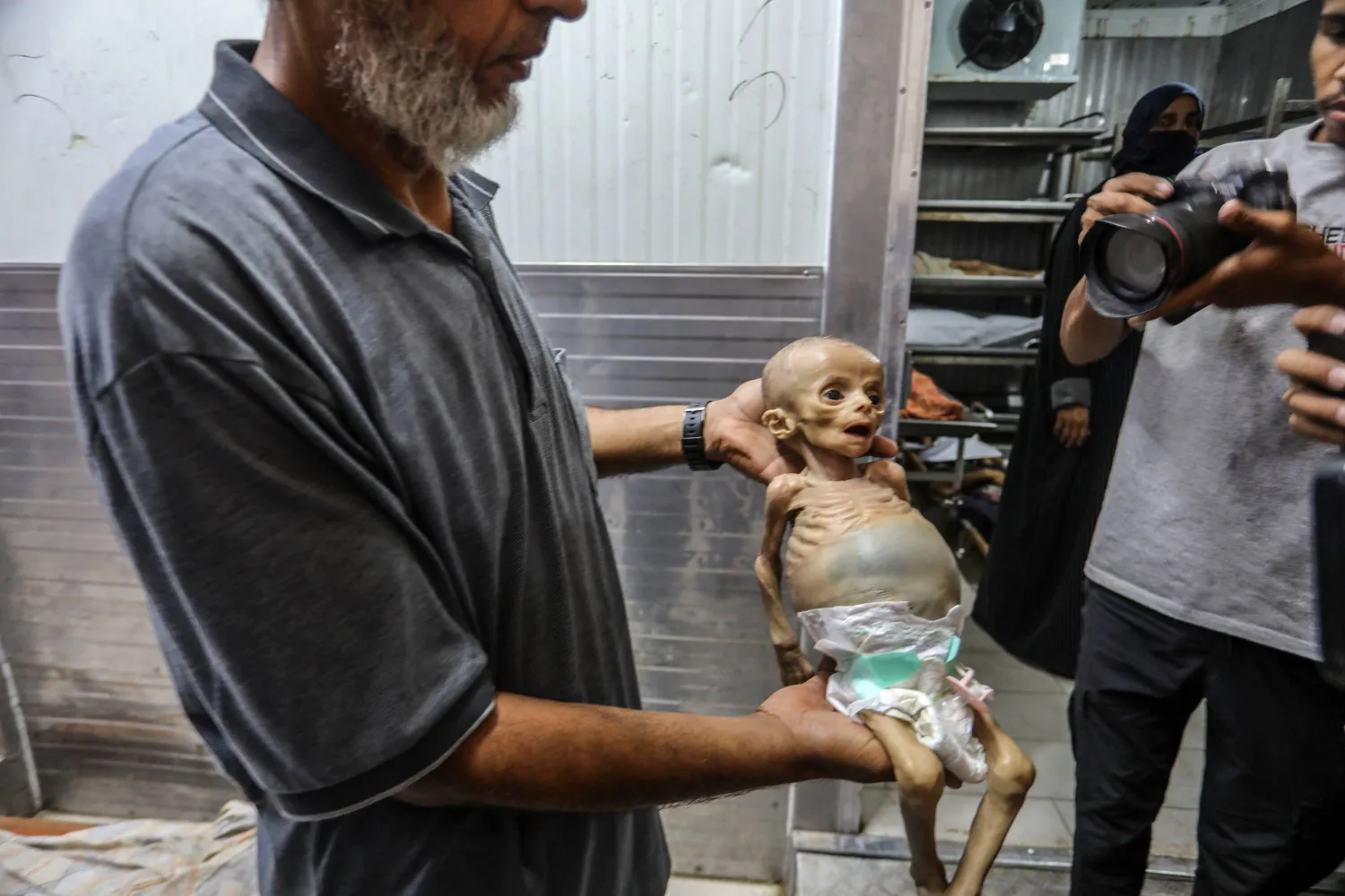 رجل يحمل الرضيعة الفلسطينية زينب أبو حليب البالغة من العمر ستة أشهر بعد وفاتها في مستشفى ناصر بخان يونس بسبب سوء التغذية الحاد (د.ب.أ)