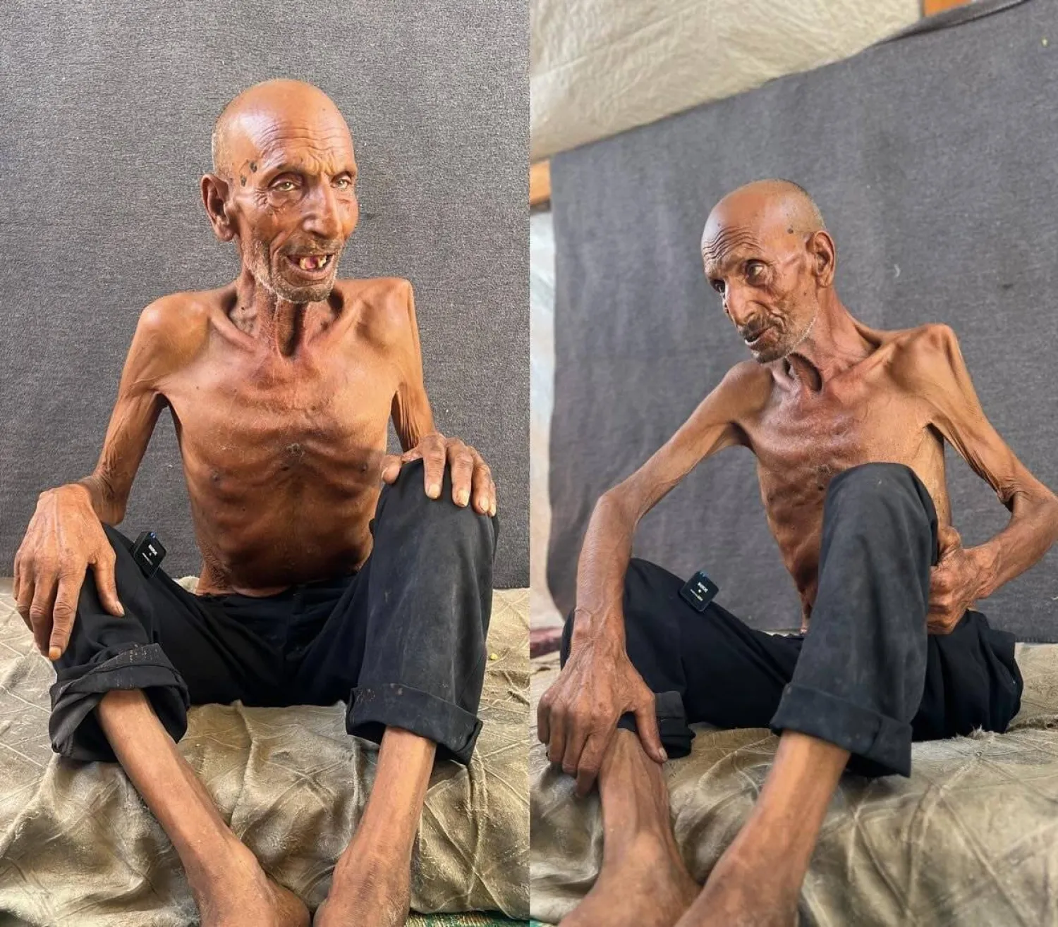 الجوع ينهش جسد المسن الفلسطيني سليم عصفور (وسائل إعلام فلسطينية)