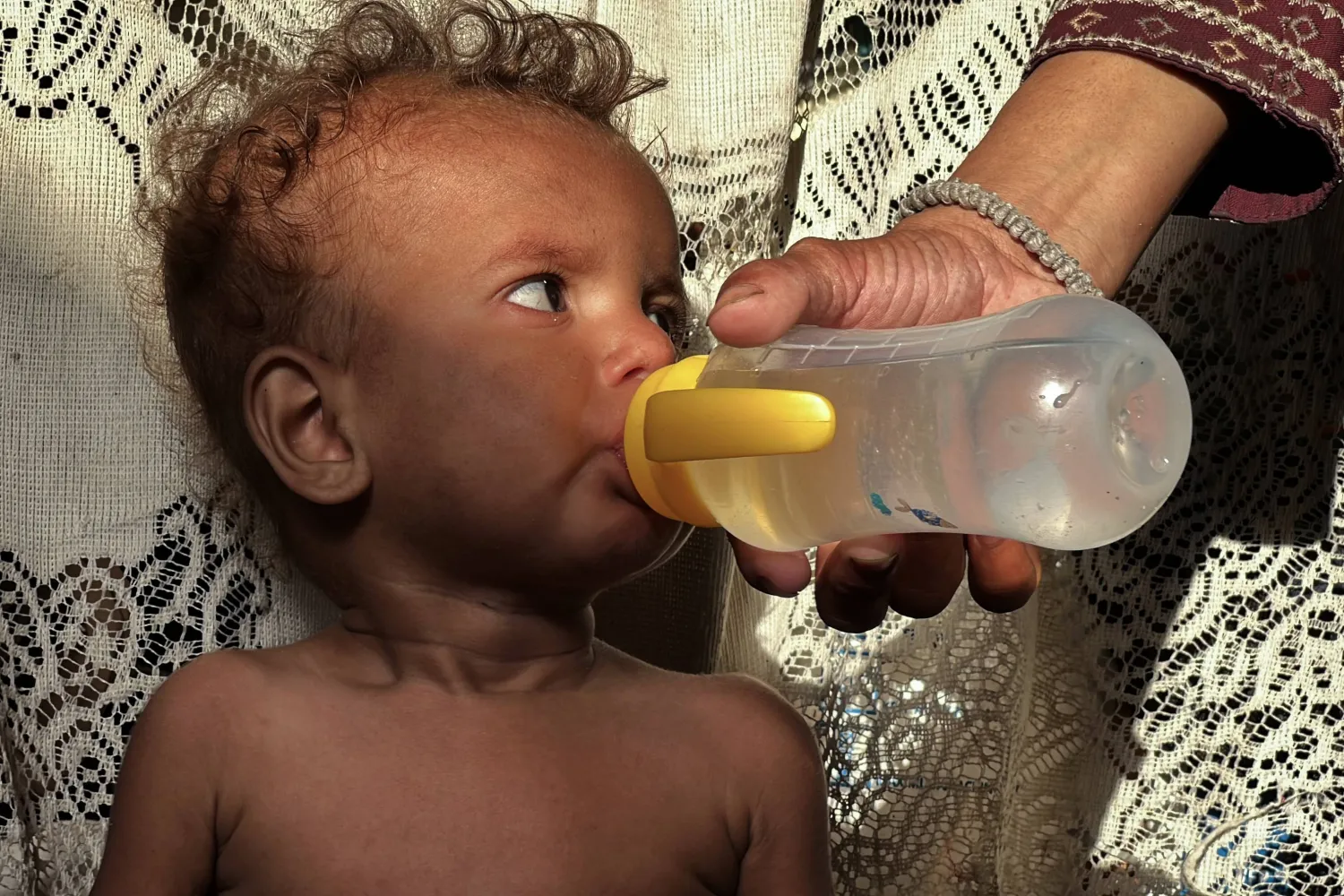 فلسطينية تسقي طفلها المصاب بسوء تغذية حاد في مخيم النصيرات للاجئين بوسط غزة الجمعة (د.ب.أ)