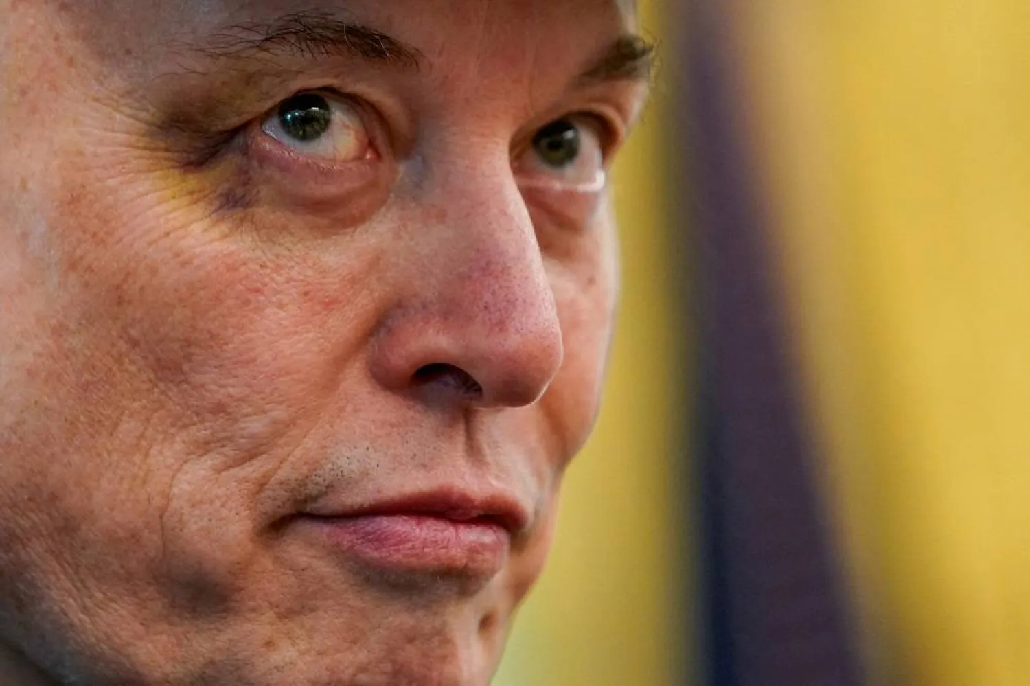Elon Musk is seen with a bruised eye that Musk claimed he received at the hands of his son, X Æ A-12, as he attends a press conference with US President Donald Trump in the Oval Office at the White House in Washington, DC, US, May 30, 2025. (Reuters) 