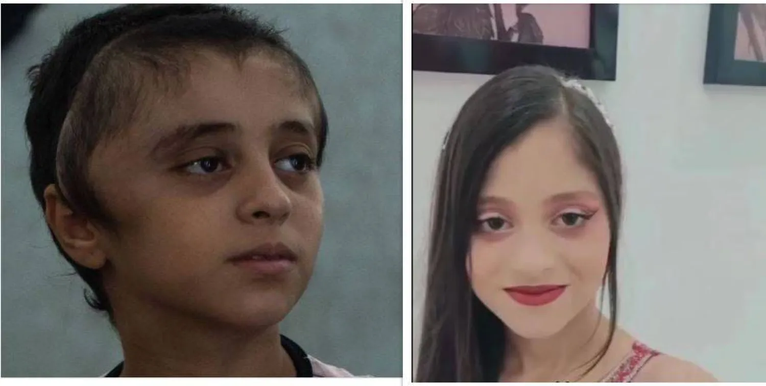 على اليمين صورة لمريم إبراهيم قبل الإصابة في الحرب، ويسارا صورة لها بعد الإصابة (وسائل إعلام محلية - إ.ب.أ)