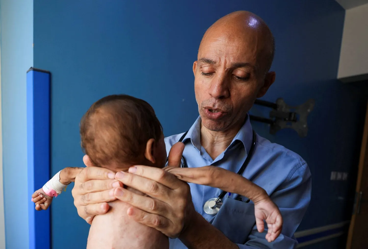 Palestinian doctor Ahmed Basal examines a child for malnutrition at Al-Rantisi Hospital in Gaza City, August 7, 2025. REUTERS/Dawoud Abu Alkas