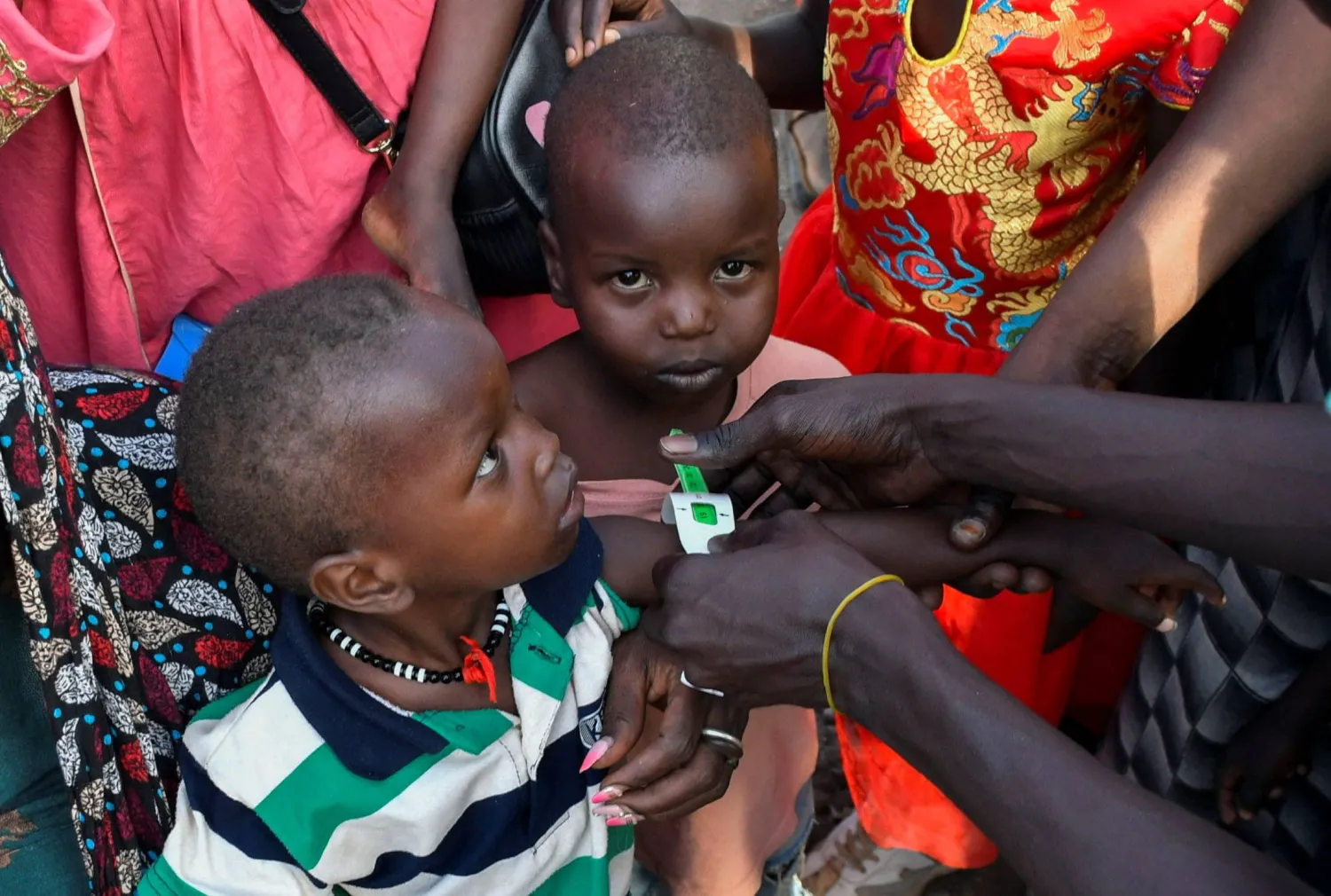 يتم فحص أطفال سودانيين بحثاً عن سوء التغذية في مفوضية الأمم المتحدة لشؤون اللاجئين بعد عبورهم عند نقطة حدود جودا الجنوبية بولاية أعالي النيل جنوب السودان (رويترز - أرشيفية)