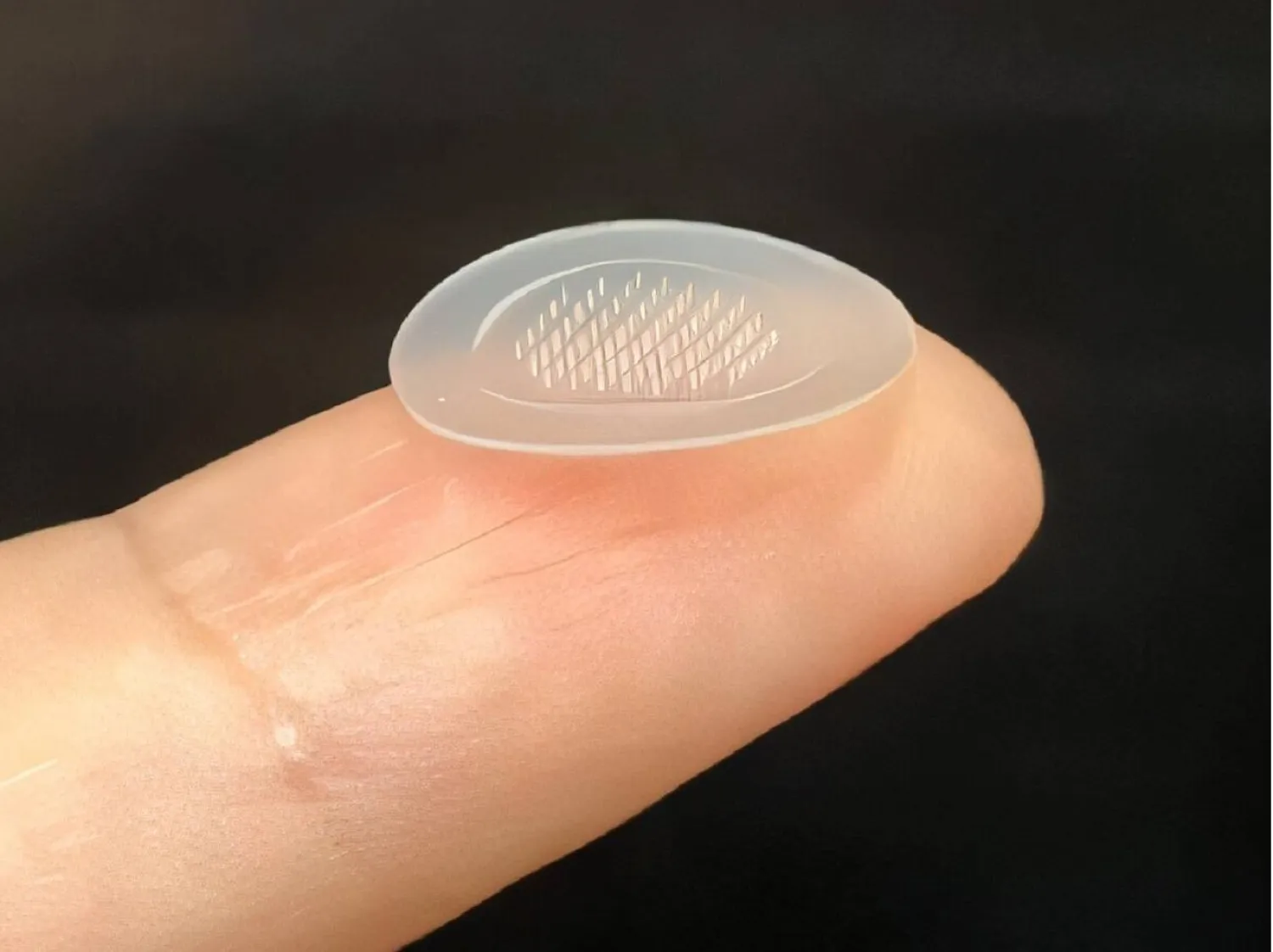 اللاصقة الجديدة تُشبه الضمادات الشفّافة الصغيرة (الجمعية الكيميائية الأميركية)