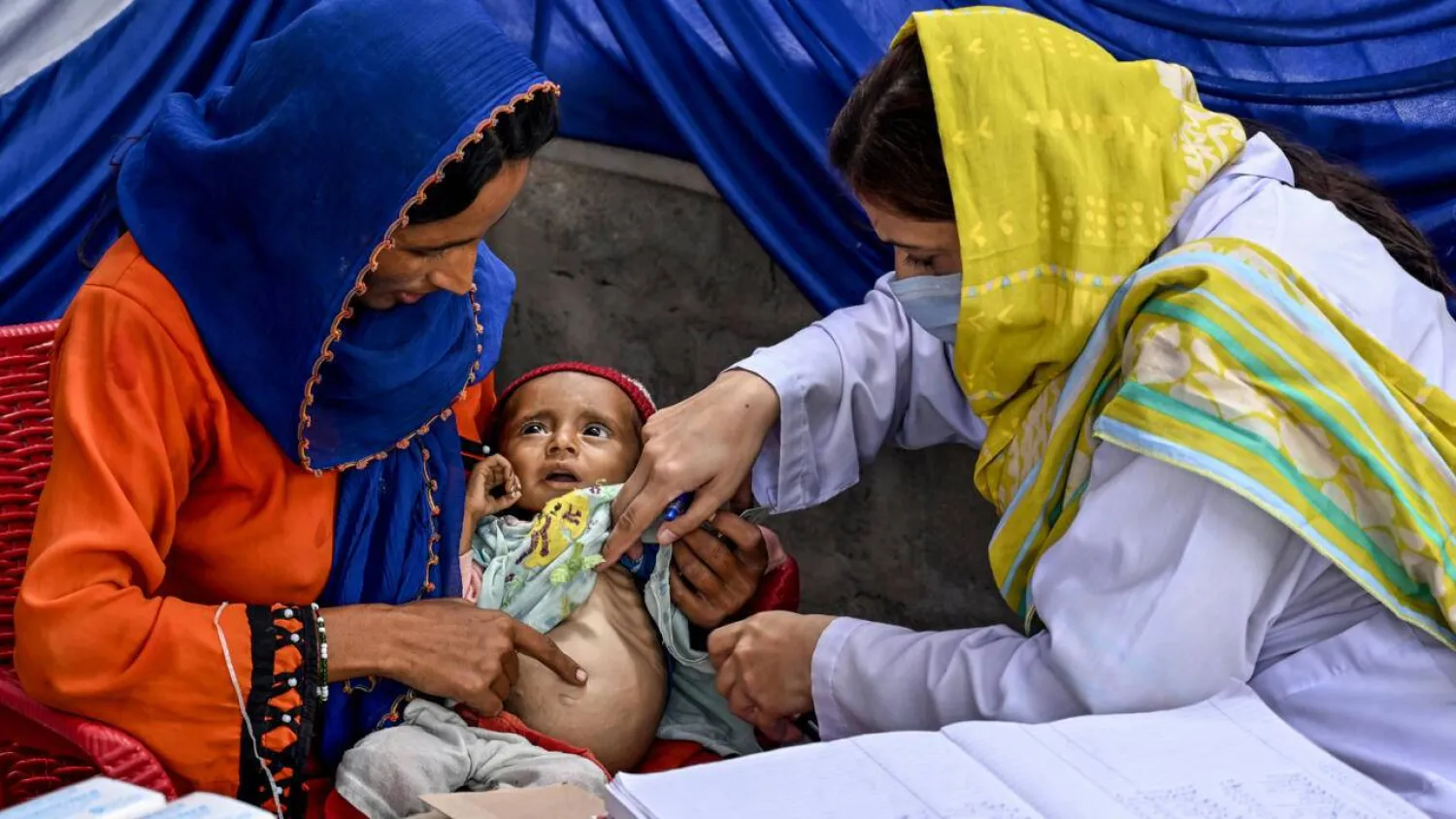 A doctor examines a child during a UNICEF nutrition program at Fateh Muhammad Soomro village in Sindh. Rizwan TABASSUM / AFP
