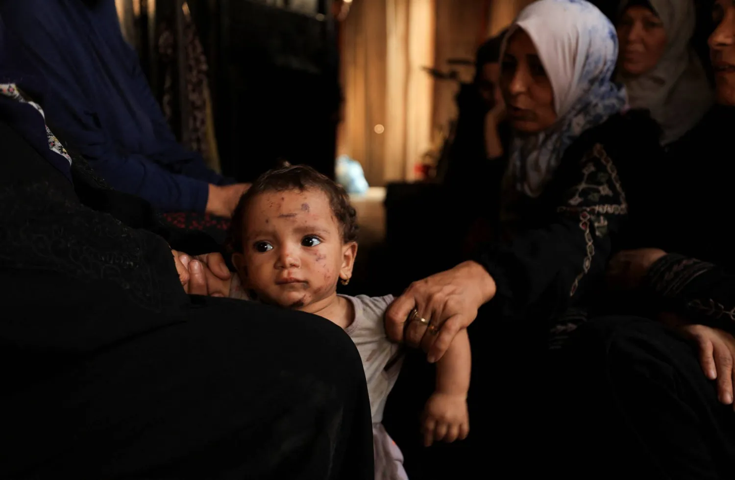 طفلة فلسطينية مصابة خلال غارة إسرائيلية في مدينة غزة (رويترز)