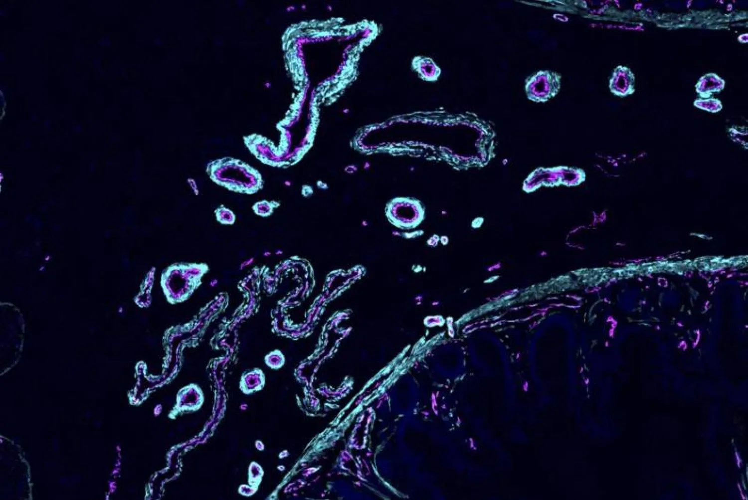 خلايا الجسم المصابة يُمكنها «تقيؤ» محتوياتها للتمكن من الشفاء سريعاً (أ.ب)
