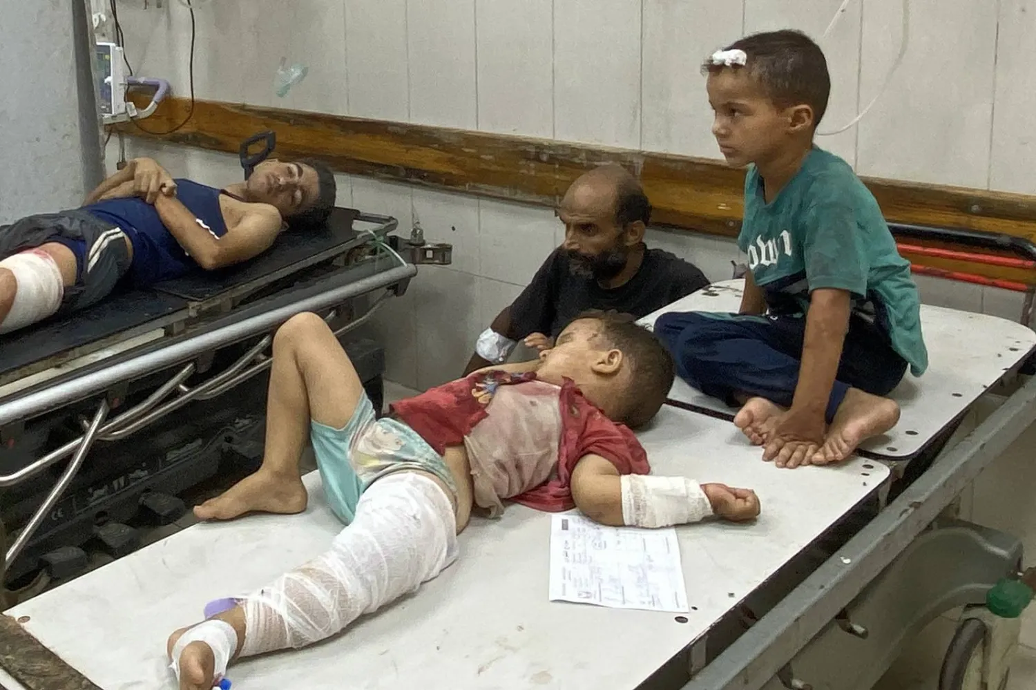 أطفال مصابون ينتظرون العلاج في مجمع ناصر الطبي بخان يونس جنوب قطاع غزة (أ.ف.ب)